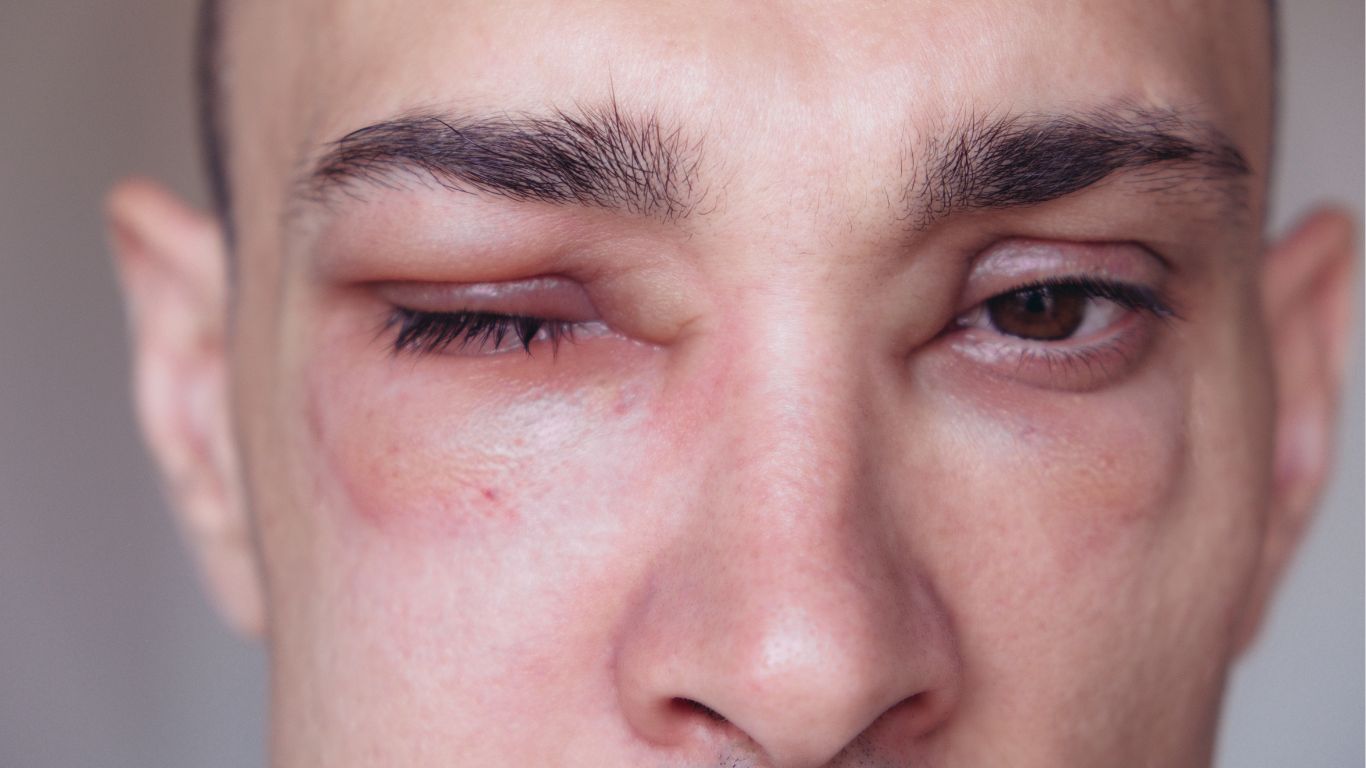 di-ung-khi-tiem-phong-uon-van-nguyen-nhan-va-cach-xu-tri 2