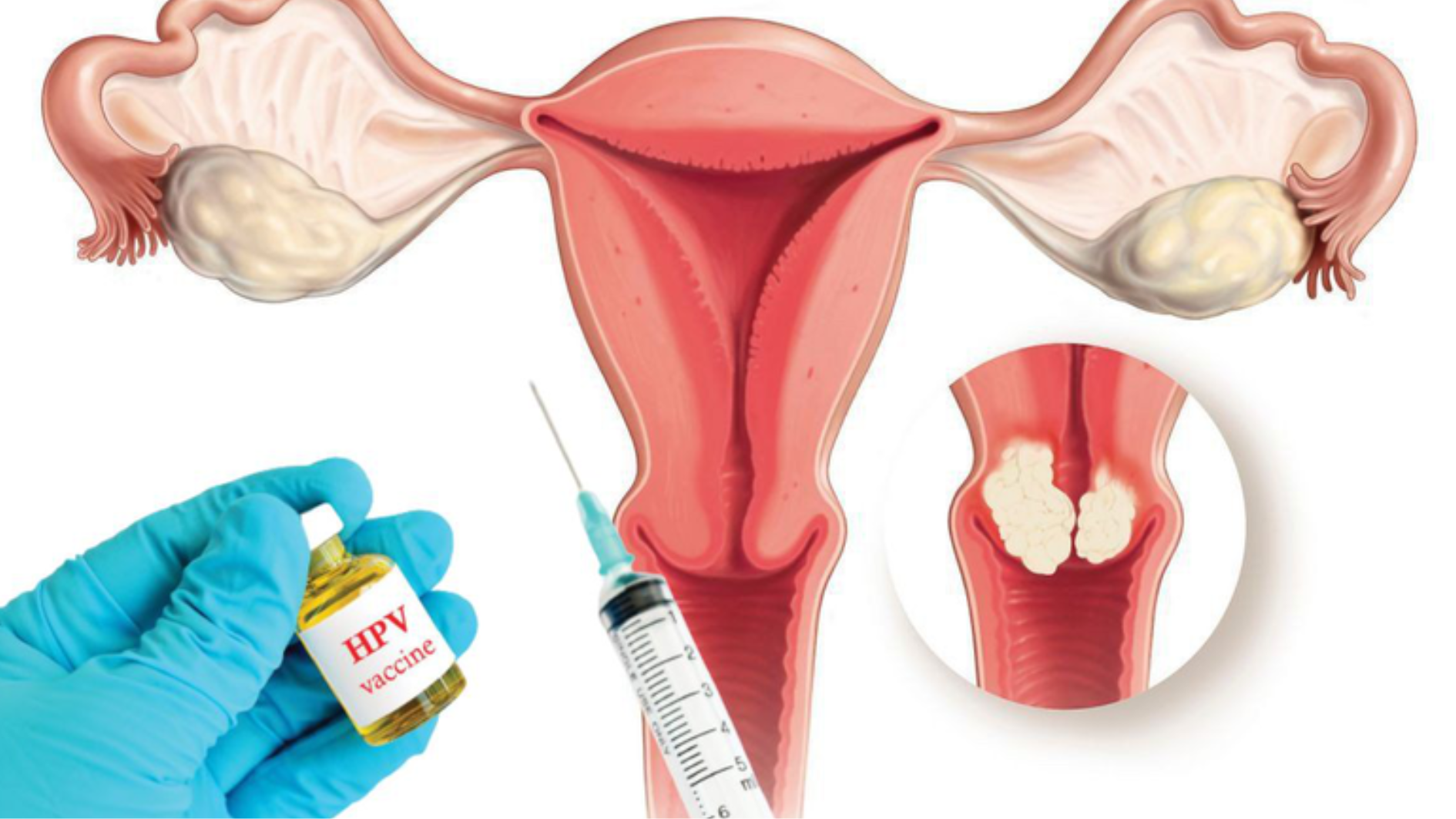 dia-chi-tiem-hpv-o-ben-tre-uy-tin-an-toan-gia-tot (1).png