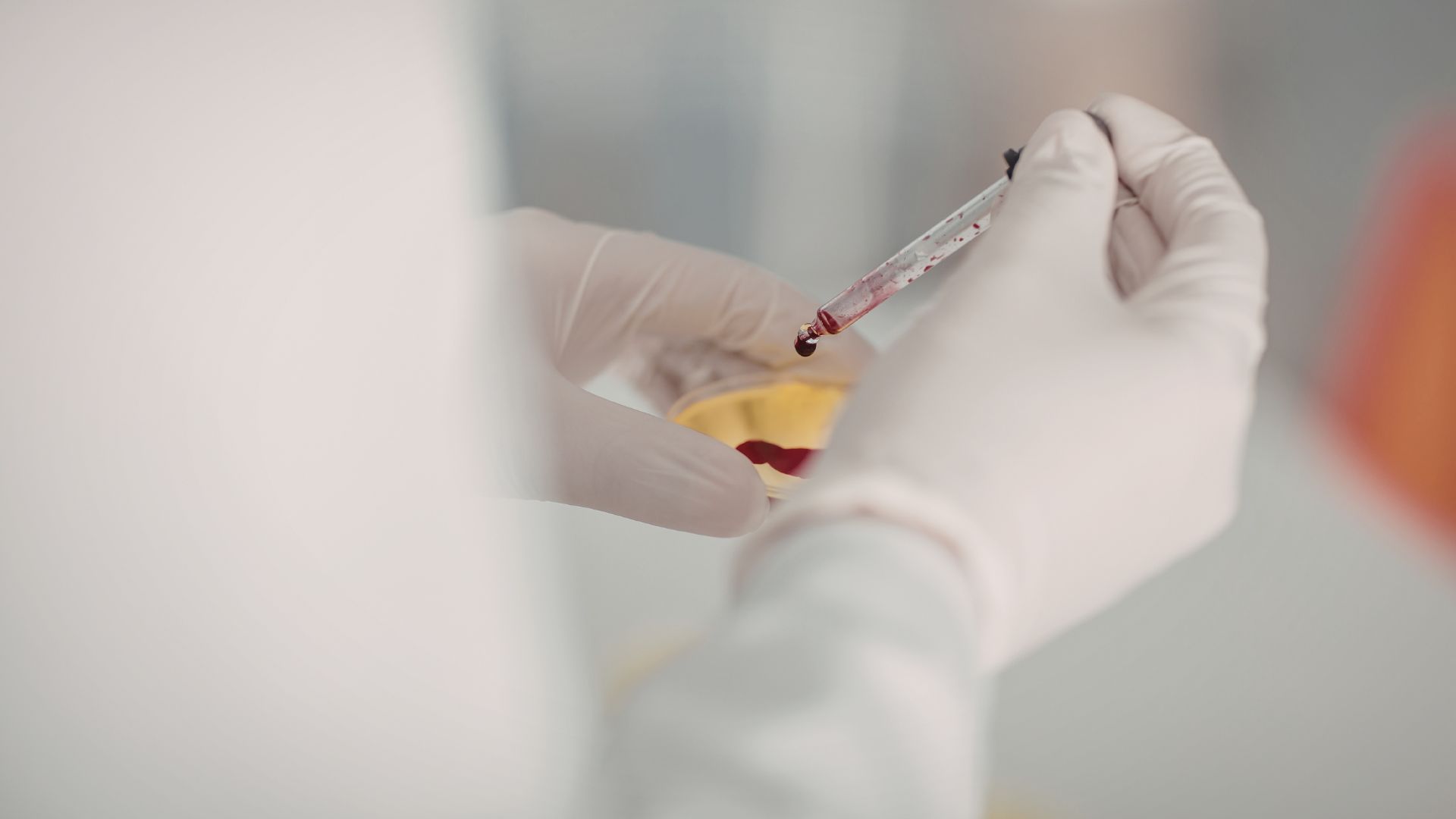 Điện di huyết sắc tố là kỹ thuật xét nghiệm chuyên sâu trong lĩnh vực huyết học nhằm phát hiện và phân tích các loại hemoglobin (Hb) có trong máu người