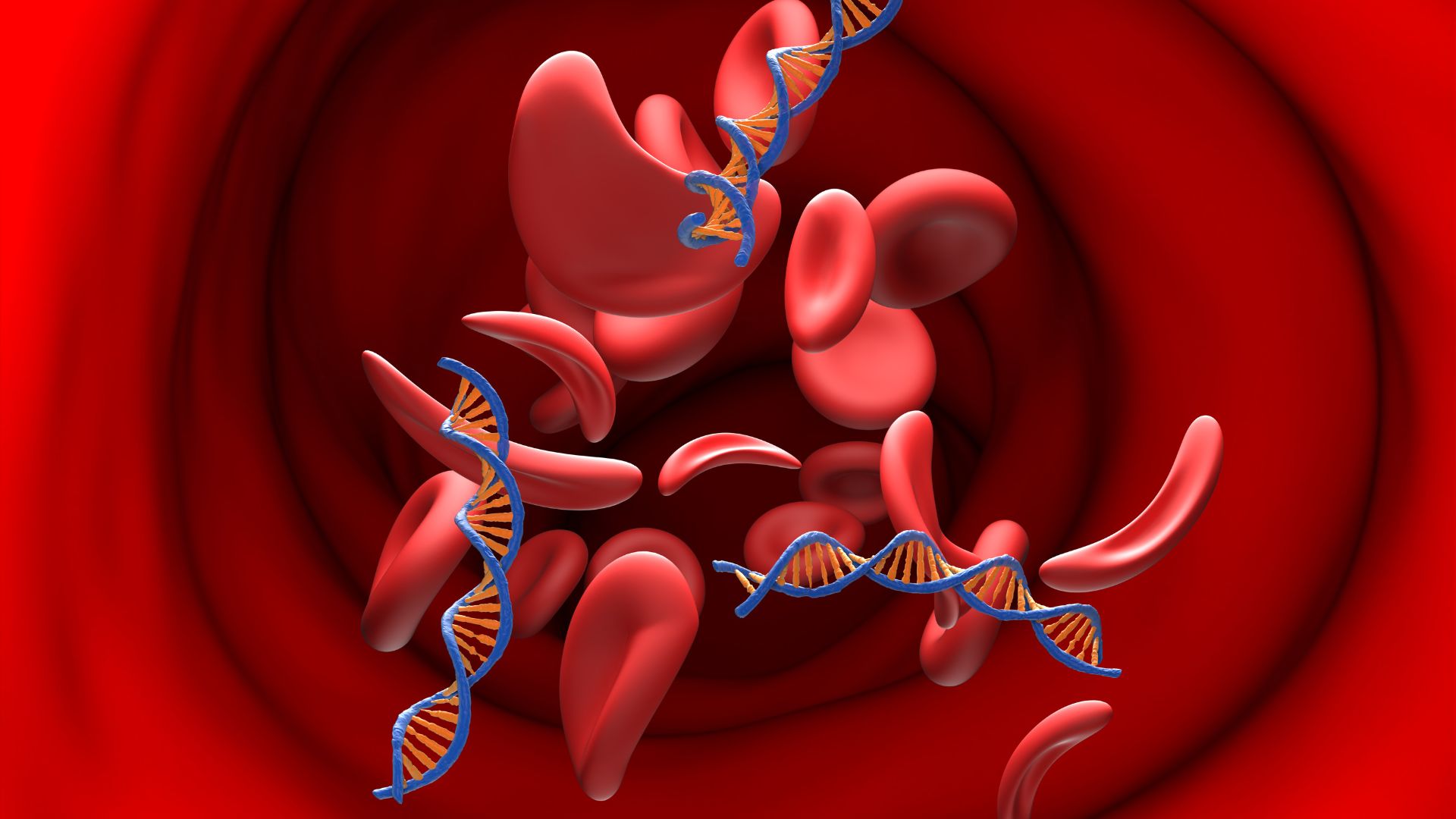 Điện di huyết sắc tố giúp chẩn đoán nguyên nhân thiếu máu mạn tính