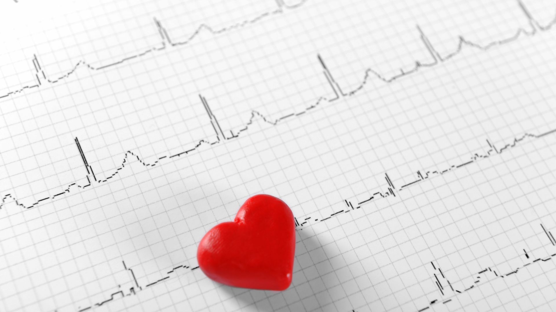 Điện tim bình thường không đồng nghĩa với việc loại trừ hoàn toàn bệnh tim