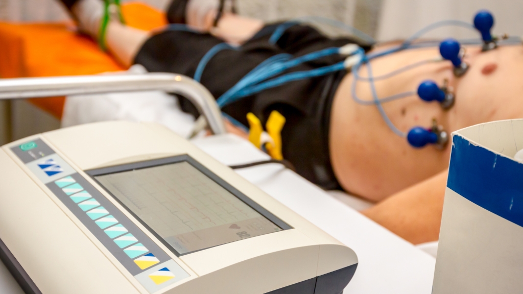 Điều trị nhồi máu cơ tim: Chẩn đoán, phác đồ và phòng ngừa tái phát 1