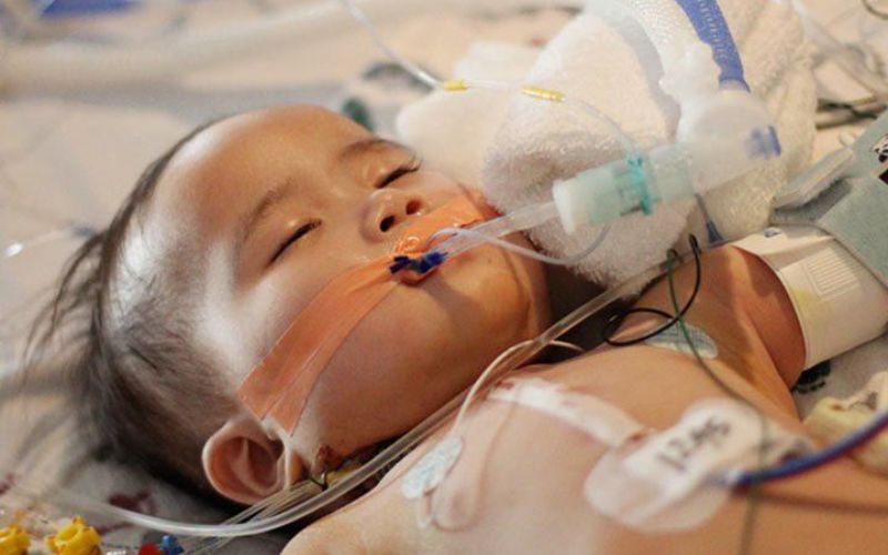 Trẻ có thể được hỗ trợ hô hấp trong trường hợp suy hô hấp hoặc sốc