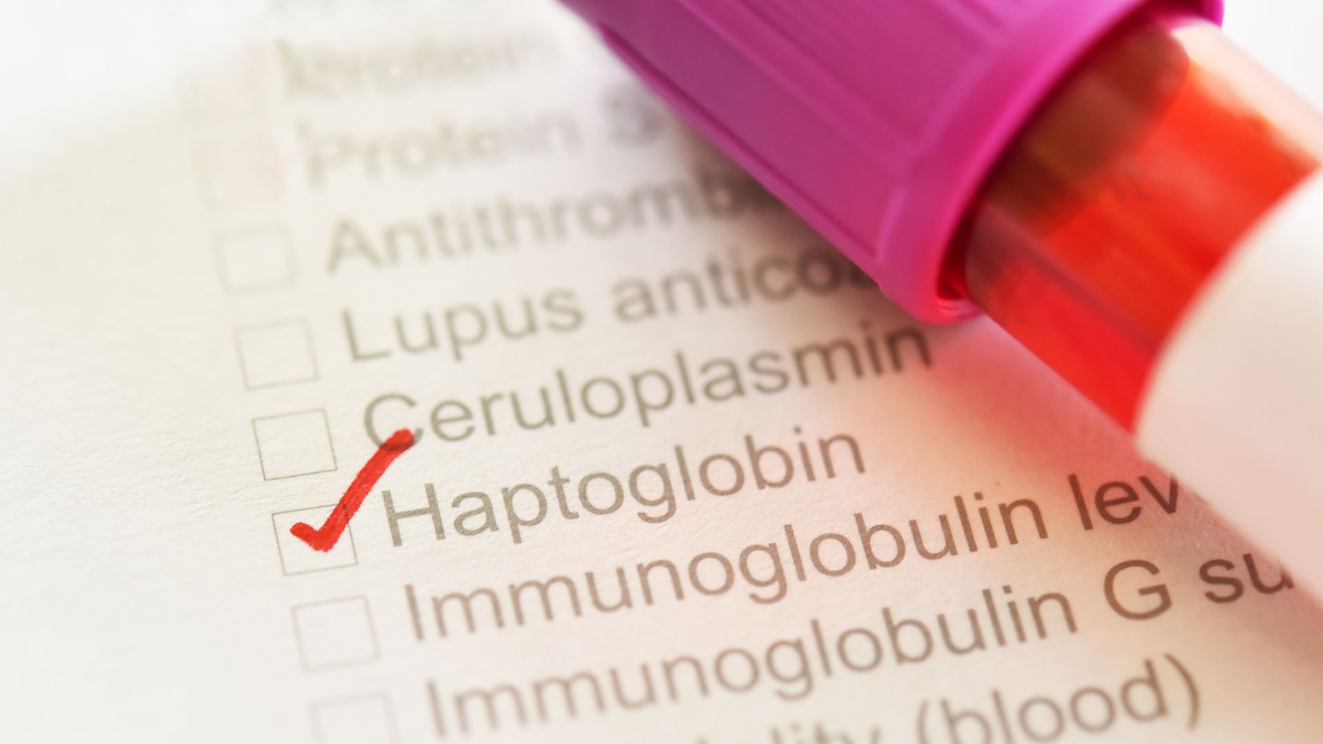 Định lượng Haptoglobin là một trong những công cụ cận lâm sàng được chỉ định trong chẩn đoán và theo dõi các bệnh lý huyết học và viêm