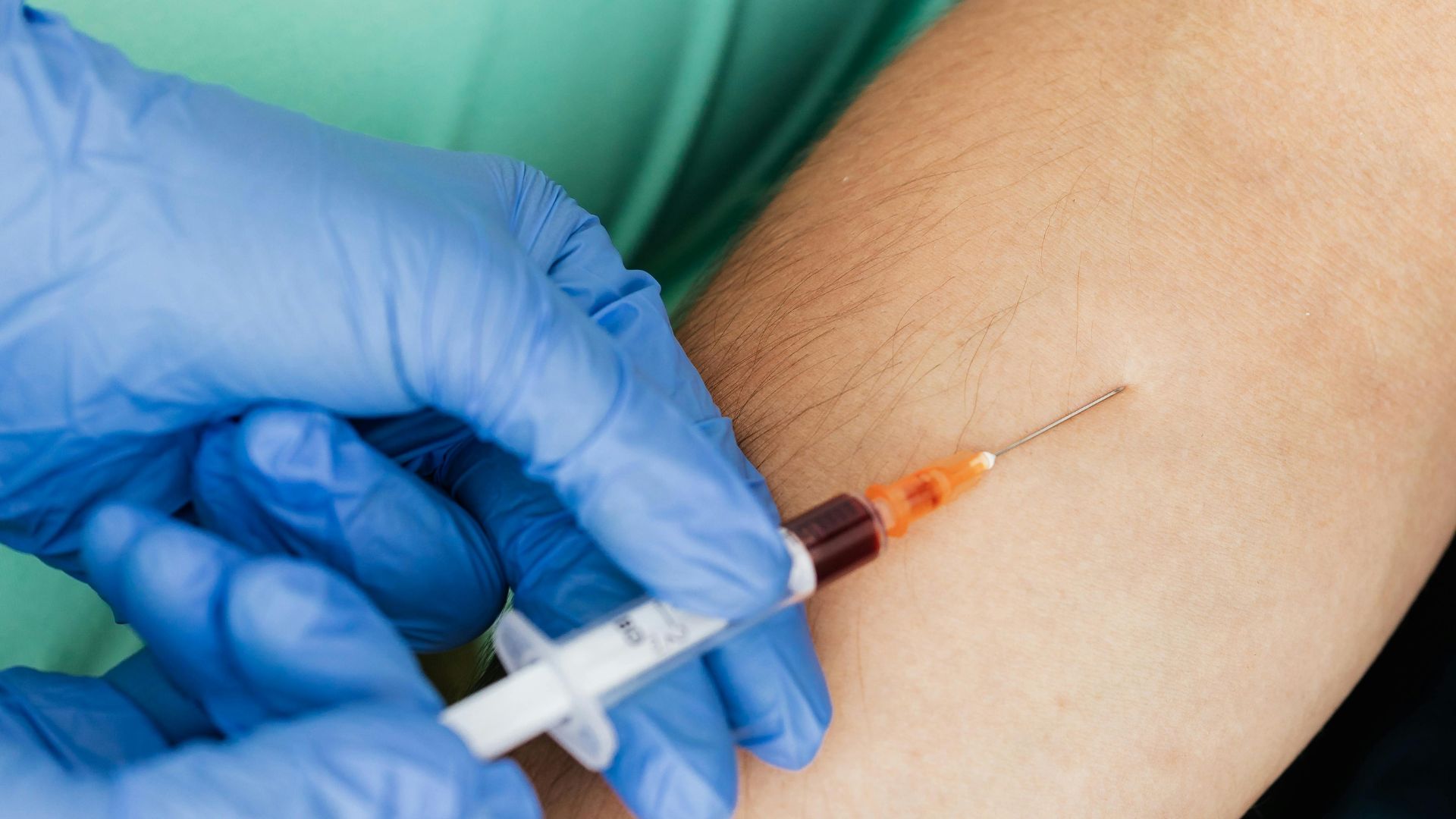 Máu tĩnh mạch được lấy bằng kim tiêm vô trùng và được thu vào ống chứa chất chống đông phù hợp