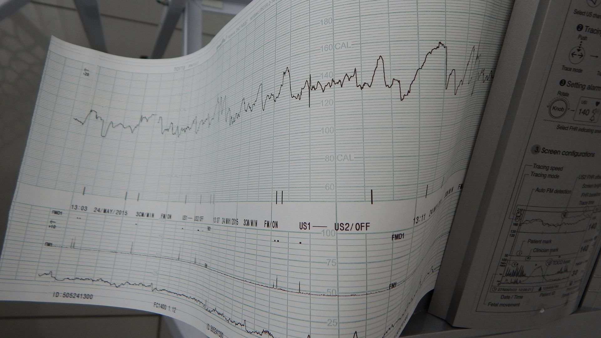 Dựa vào cơn gò tử cung để biết thai phụ sắp chuyển dạ hay chưa