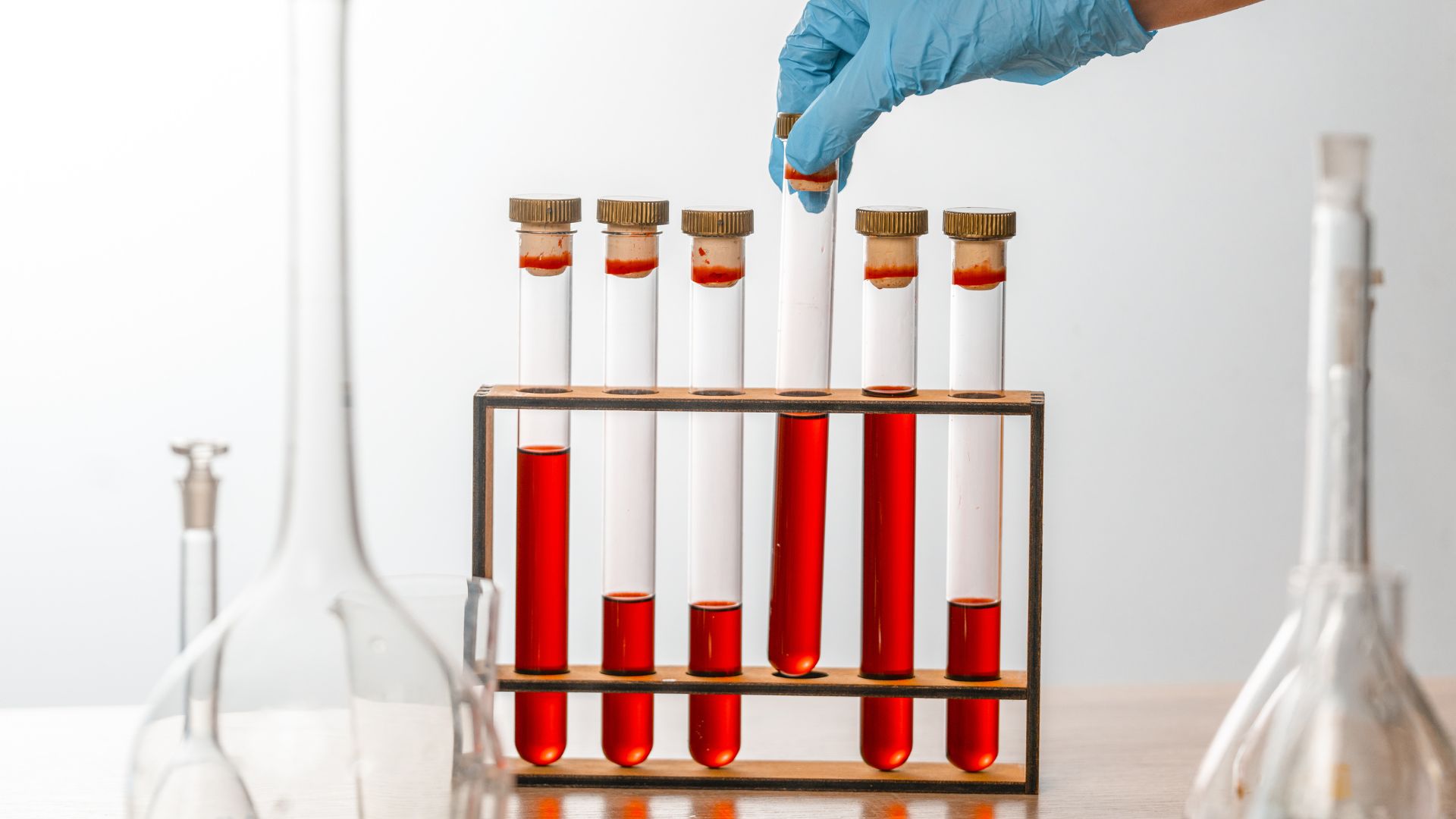 GGT đặc biệt nhạy trong việc phát hiện tổn thương gan do rượu, thuốc hoặc các chất độc khác