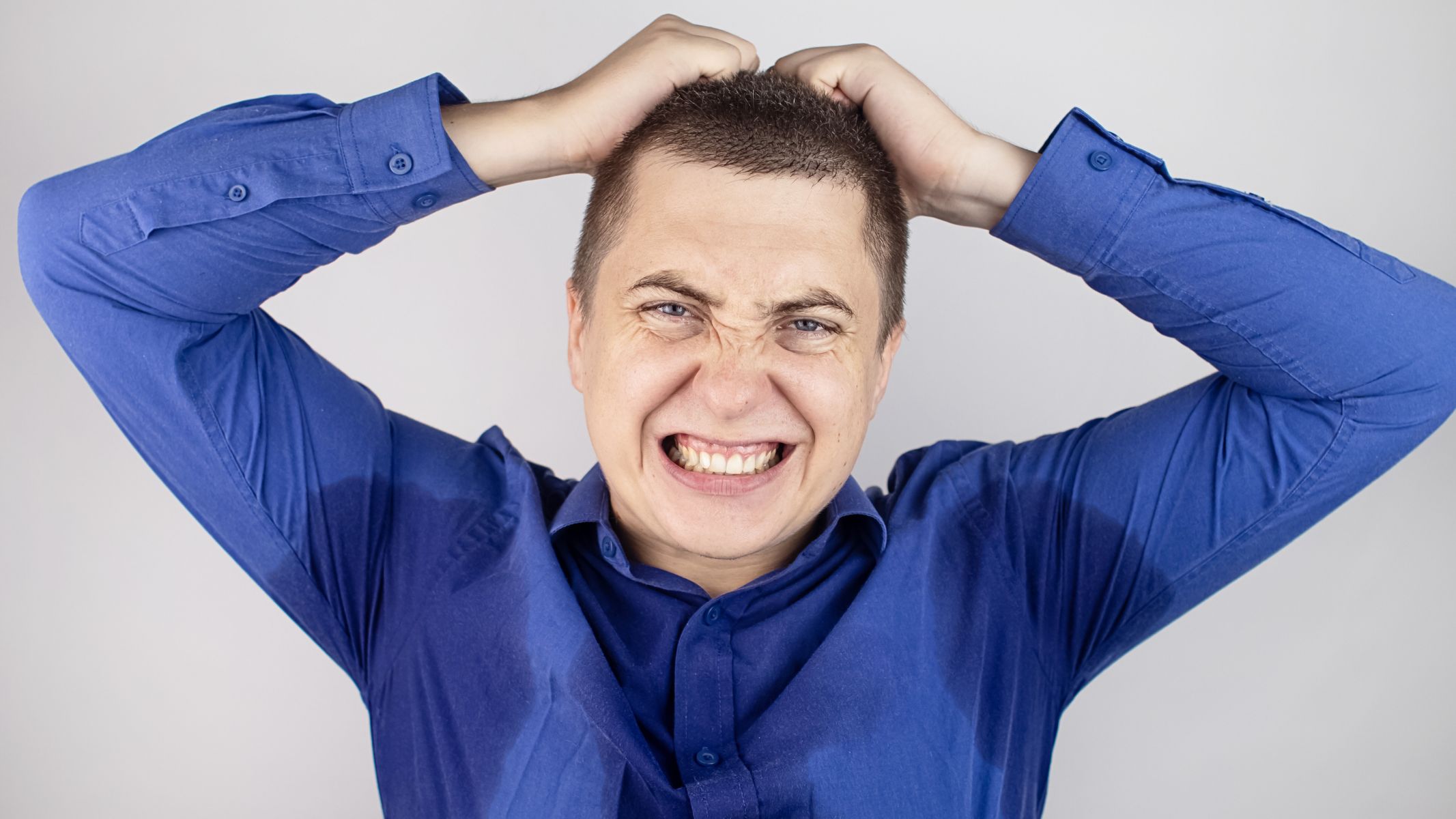 Rối loạn thần kinh giao cảm là nguyên nhân phổ biến nhất của tăng tiết mồ hôi nguyên phát