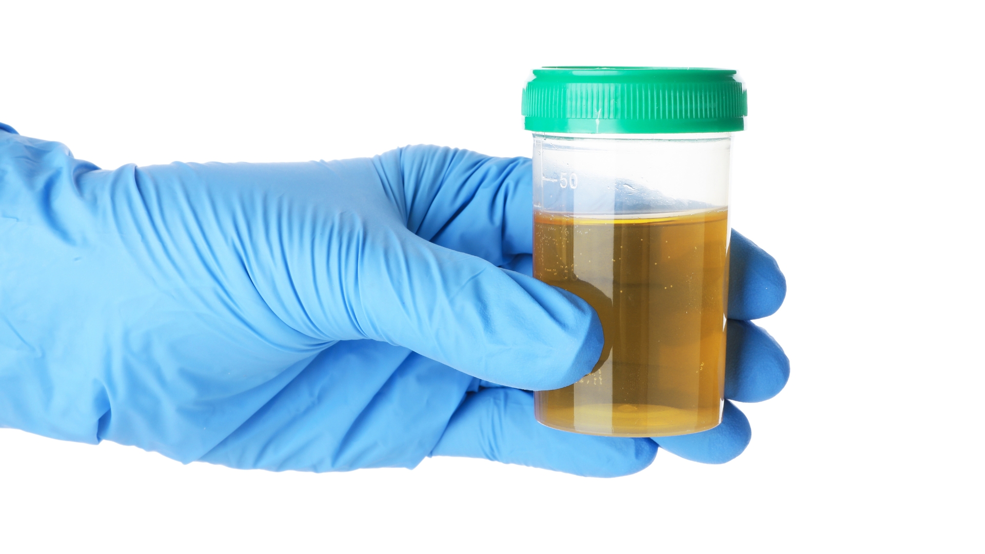 Dựa vào nồng độ creatinin trong máu và toàn bộ lượng nước tiểu trong 24 giờ, có thể xác định được độ thanh thải