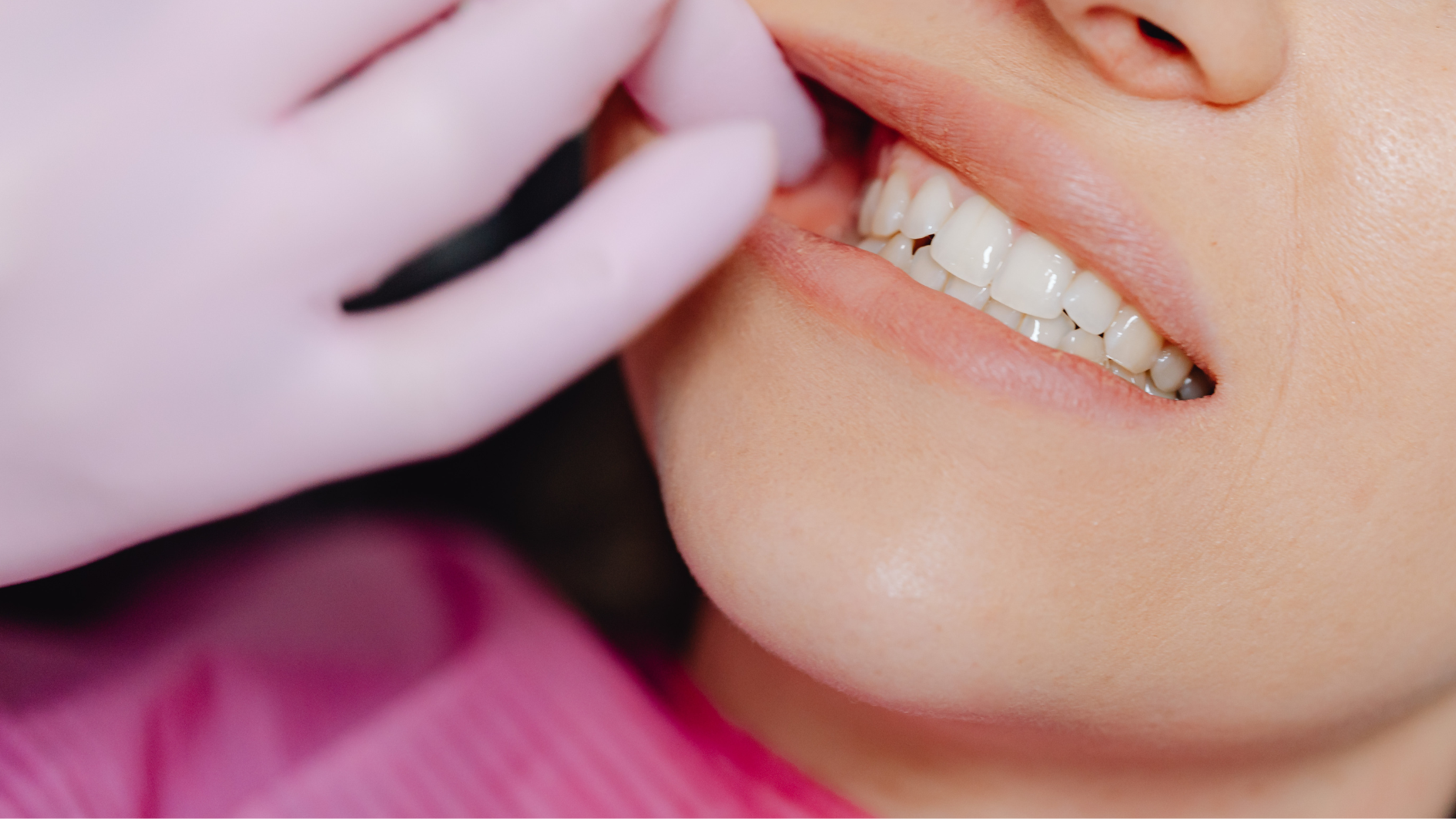 Trẻ mọc răng khôn sớm có thể ảnh hưởng quá trình mọc răng số 7