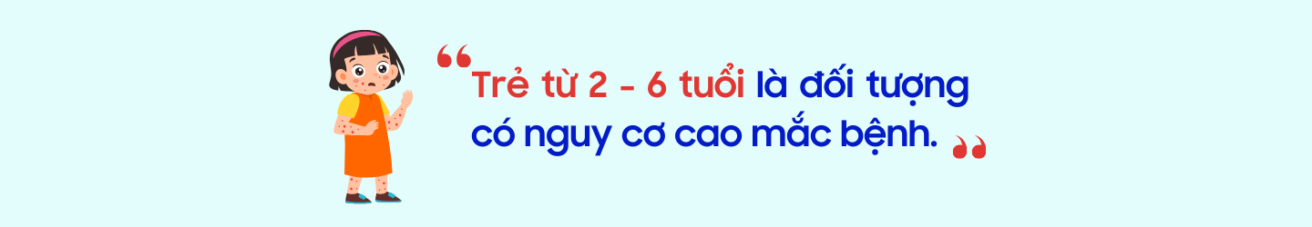 doi-tuong-co-nguy-co-cao-mac-soi.png