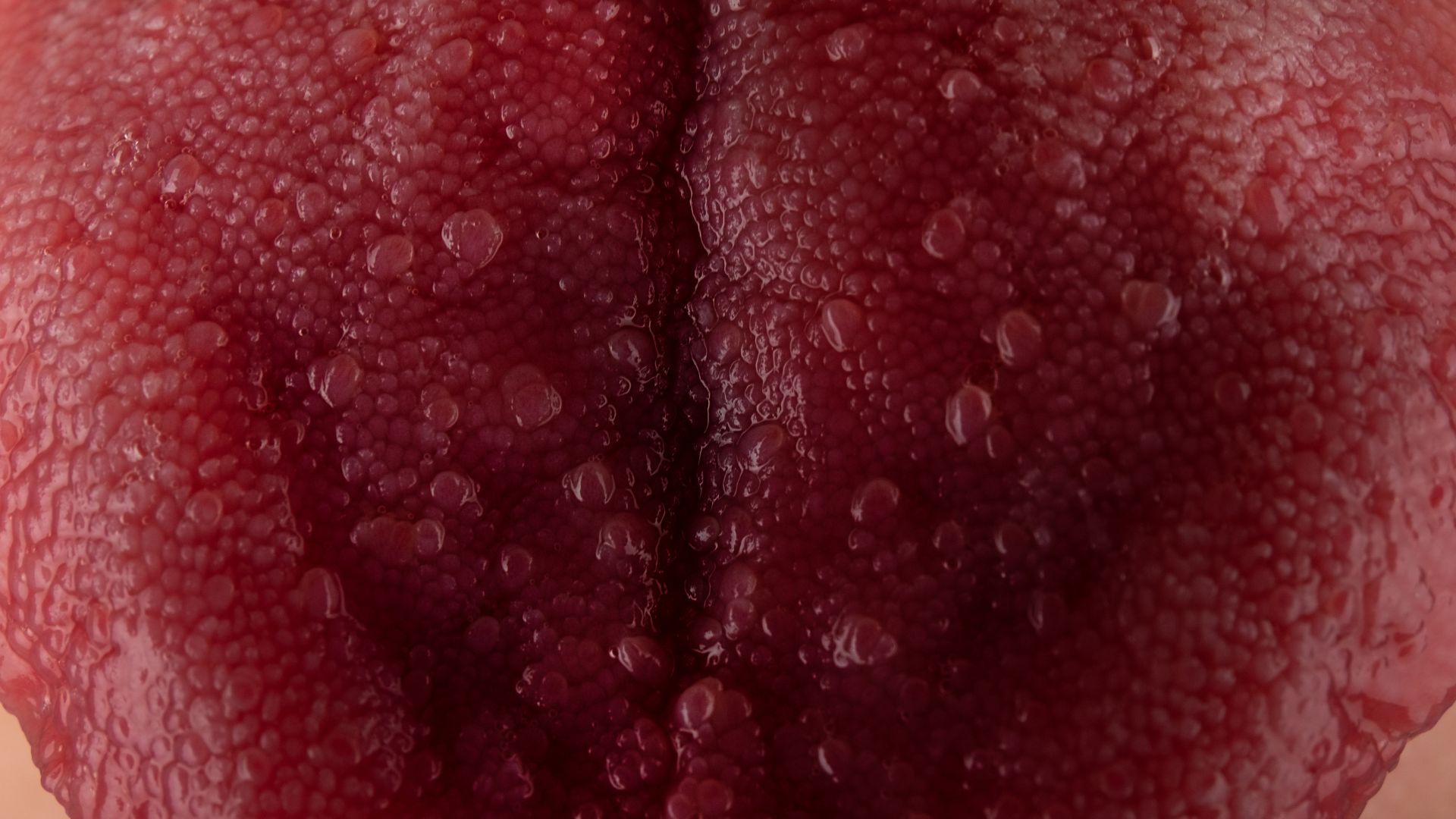 Đốm lưỡi đỏ trên lưỡi là một tình trạng có thể gặp phải ở mọi lứa tuổi