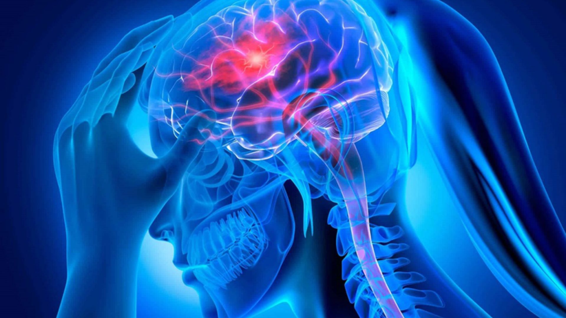 Đột quỵ ở trẻ em: Nguyên nhân, triệu chứng, chẩn đoán và điều trị 2