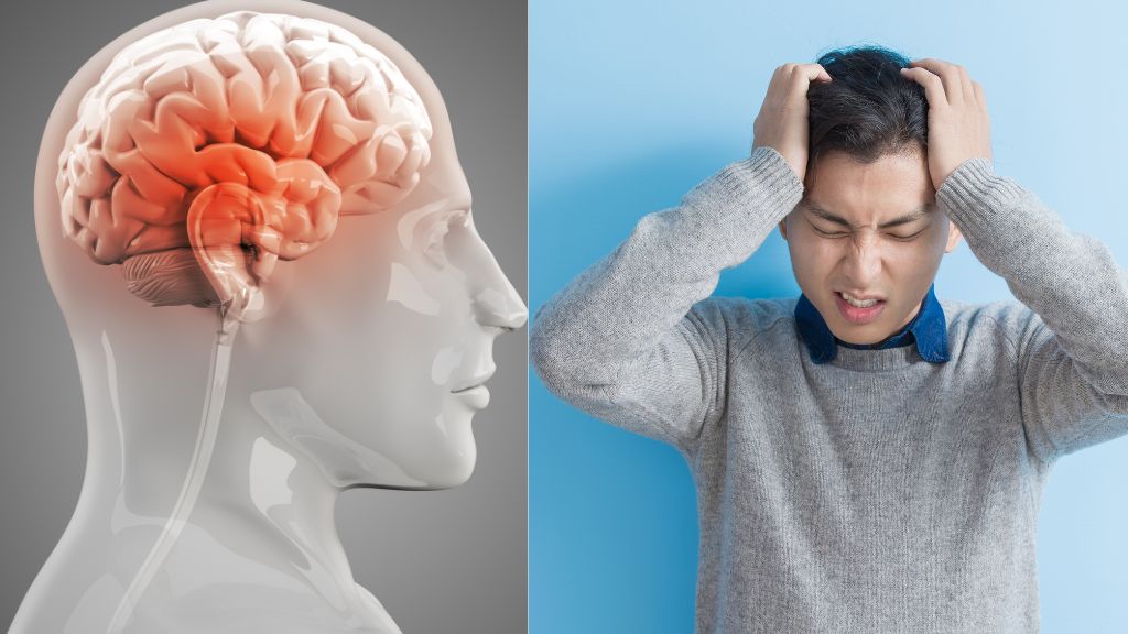 Đột quỵ xuất huyết não có dấu hiệu nào cảnh báo? Sơ cứu ra sao? 1