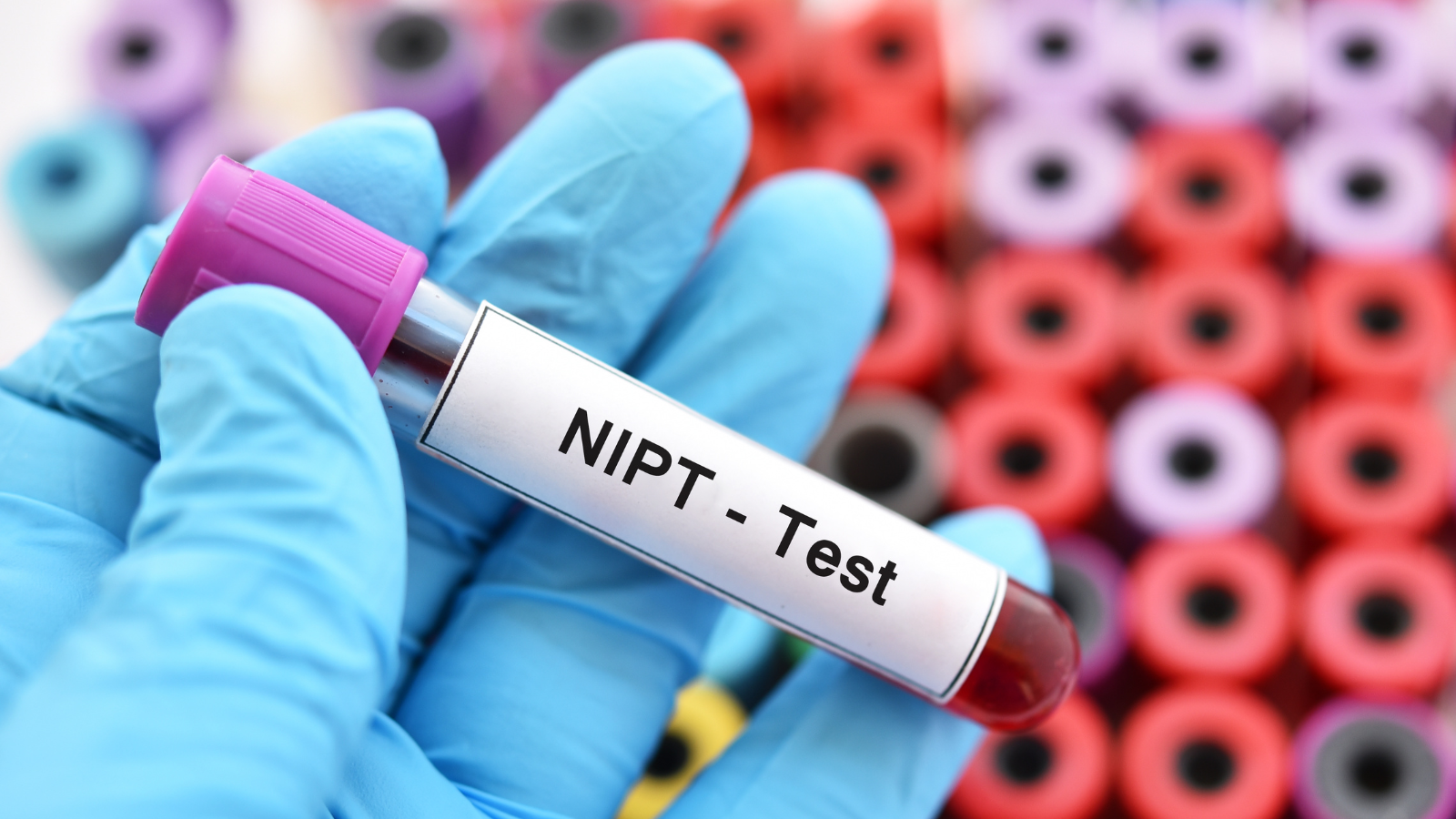 Khi quá mốc double test, mẹ bầu có thể cân nhắc NIPT theo tư vấn bác sĩ