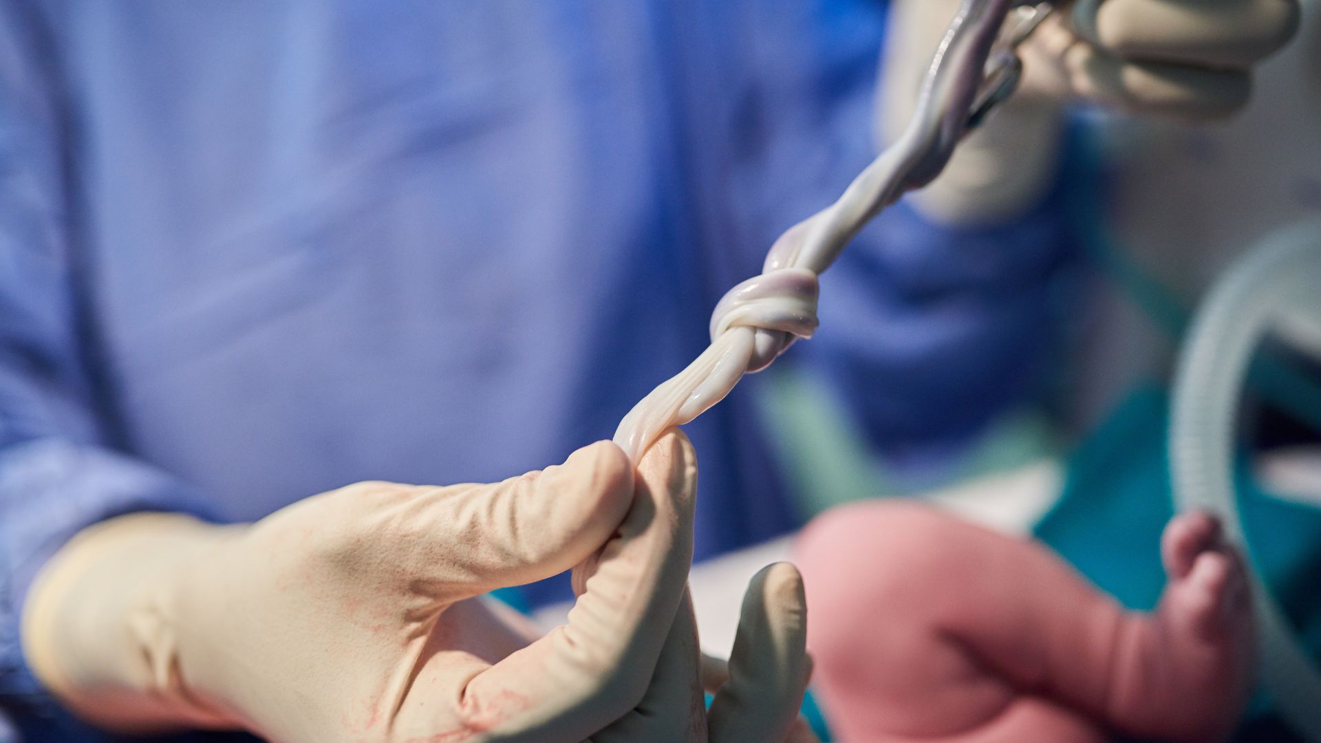 Dư ối có thể gây ra hiện tượng sa dây rốn ở thai nhi