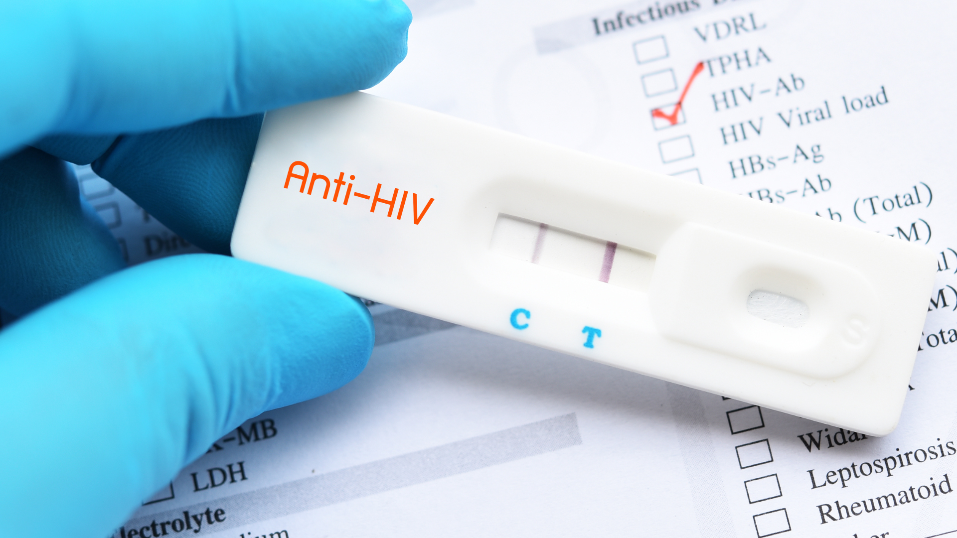 Dương tính giả HIV có thể khiến nhiều người hoang mang, lo lắng