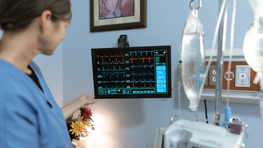 ECG nhồi máu cơ tim là gì? Dấu hiệu nhận biết và ý nghĩa trong cấp cứu 1