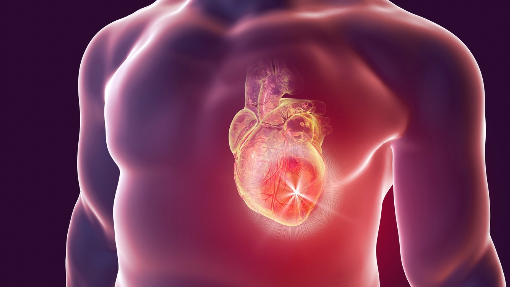 ECG nhồi máu cơ tim là gì? Dấu hiệu nhận biết và ý nghĩa trong cấp cứu 3