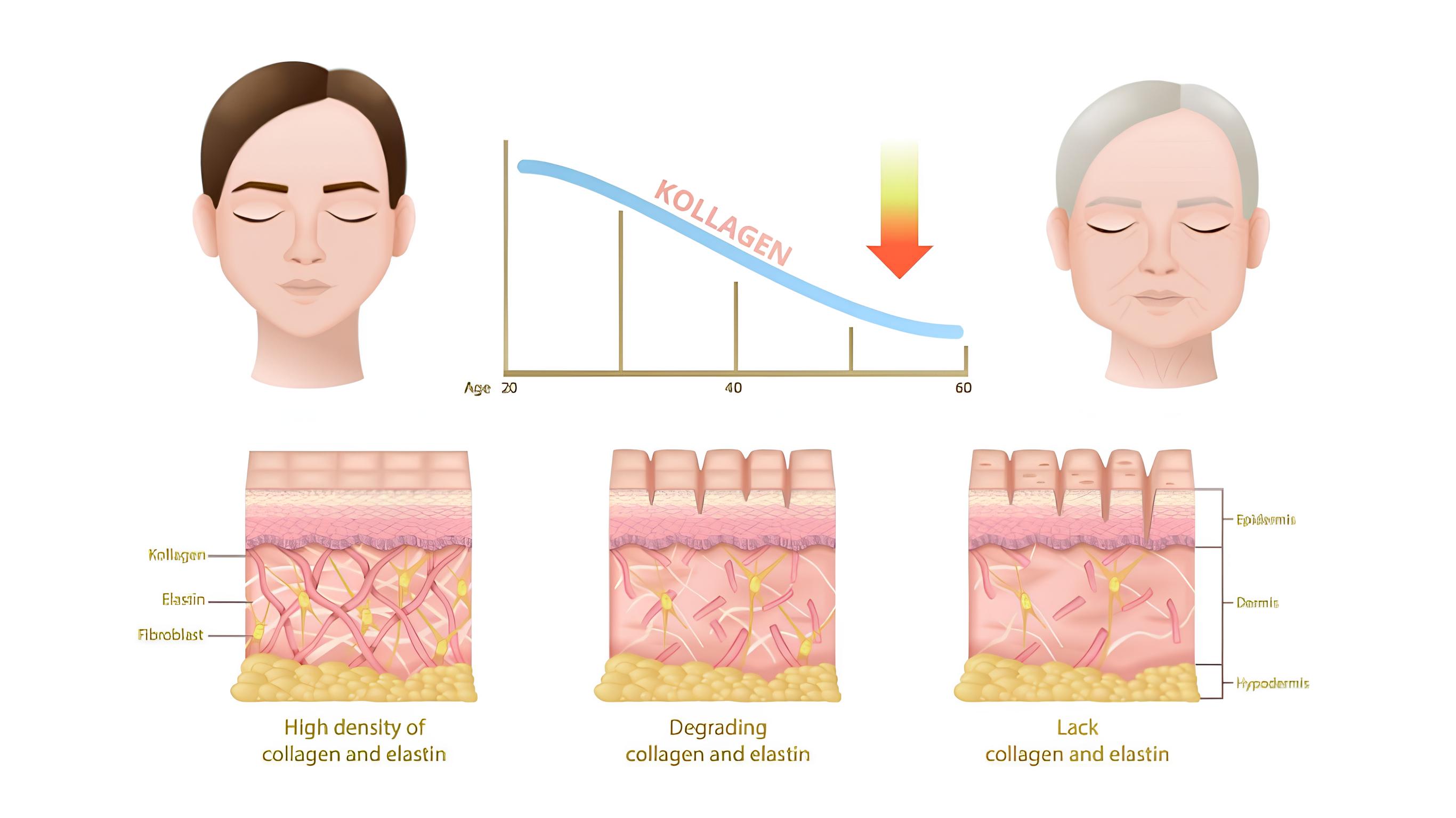 Elastin là gì? Vai trò của elastin đối với làn da 3