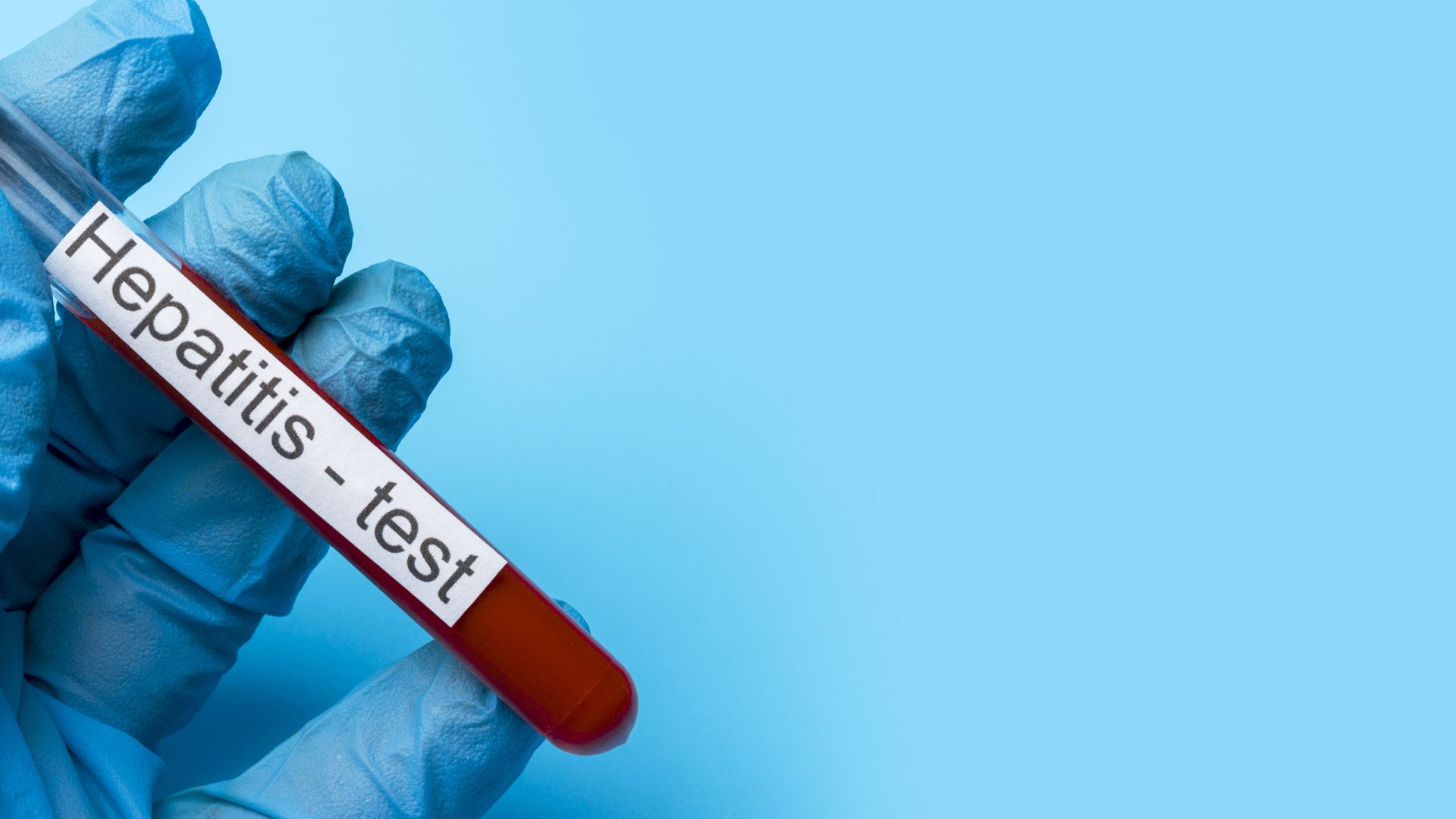 euvax-b-0-5ml-bao-ve-chung-ta-khoi-viem-gan-b 1.jpg