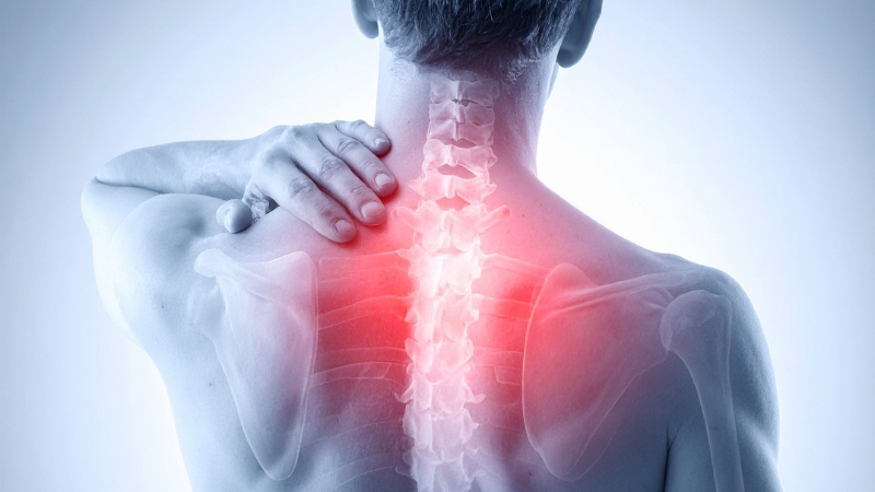 Điều trị gai cột sống cần kết hợp nhiều phương pháp để đạt hiệu quả tối ưu