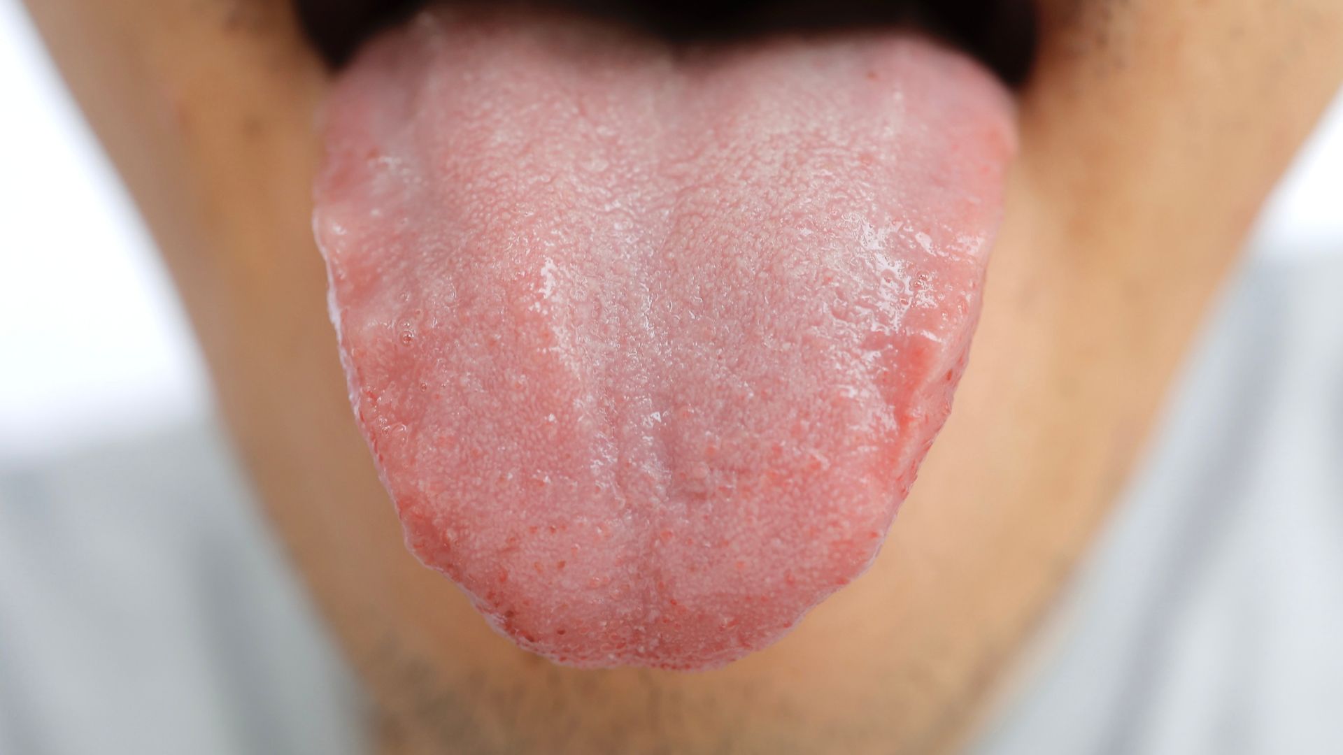 Gai lưỡi giúp cảm nhận vị giác và hỗ trợ hoạt động của lưỡi