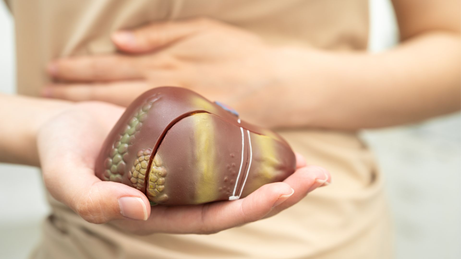 Dấu hiệu nhận biết gan nhiễm mỡ độ 2 có nguy hiểm không thường khó nhận ra ở giai đoạn sớm