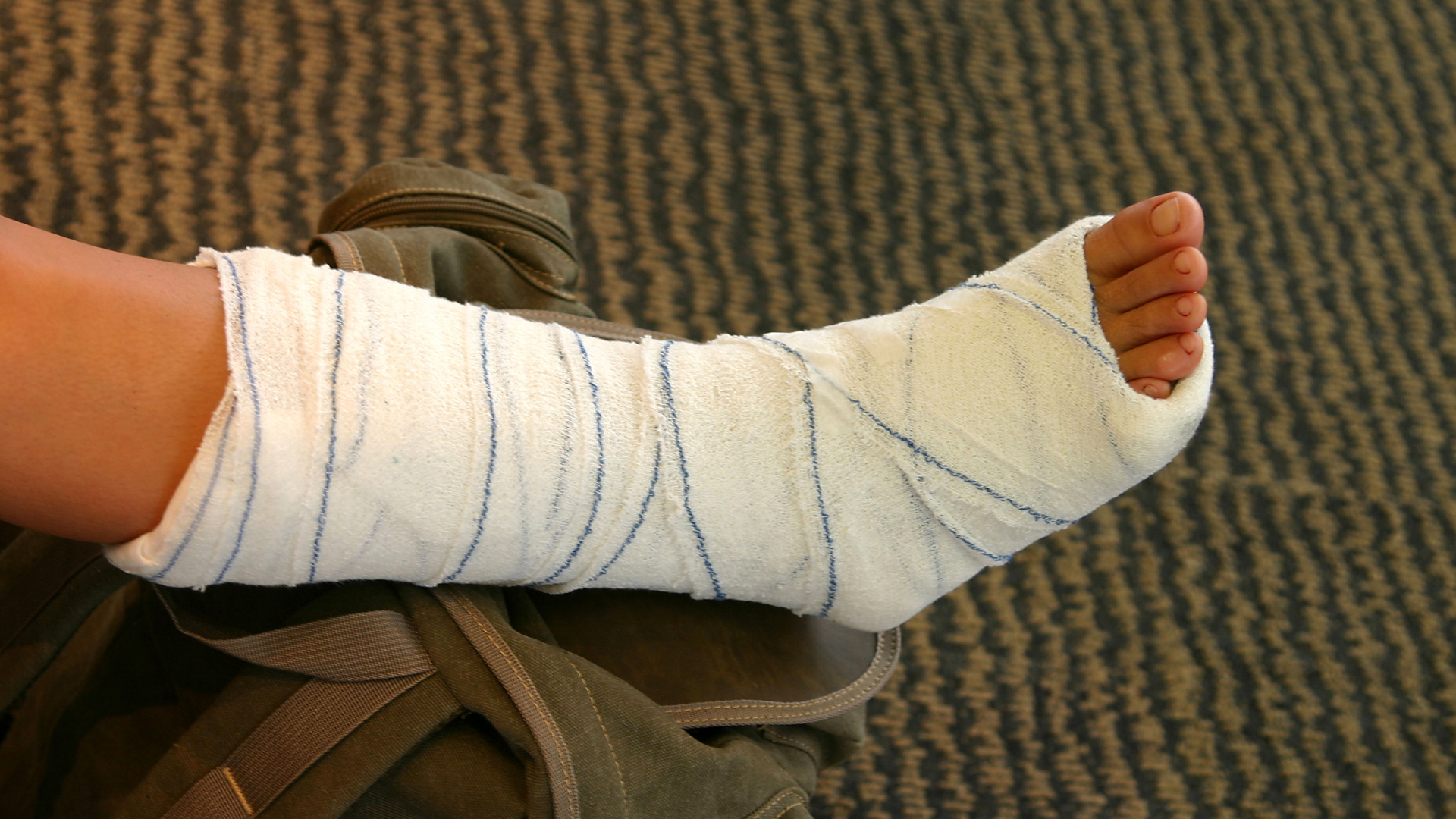 Gãy chân bao lâu thì đá bóng được? Thường 3 đến 6 tháng mới có thể quay lại sân bóng