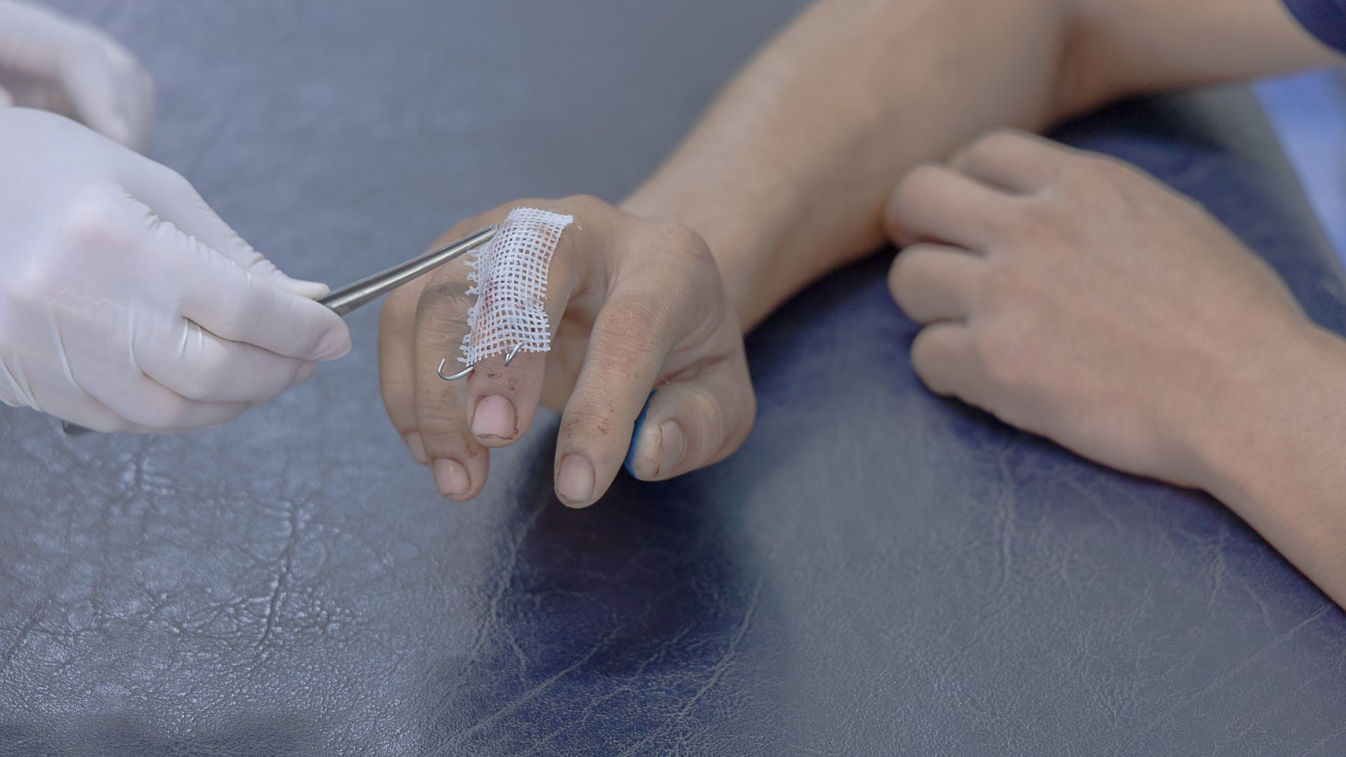 Gãy đốt ngón tay bao lâu thì lành là vấn đề mà nhiều người gặp chấn thương lo lắng