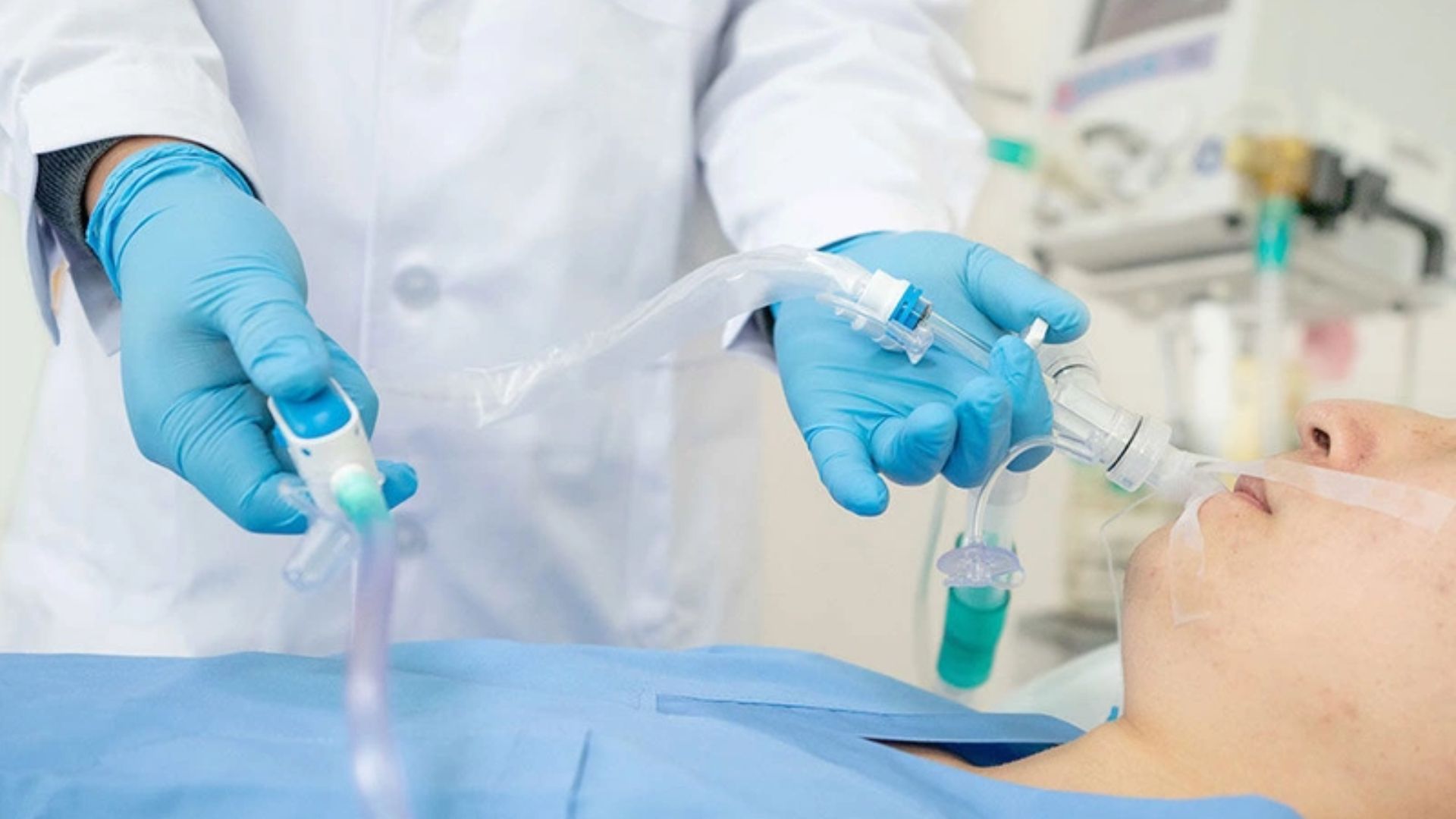 Gây mê nội khí quản là phương pháp gây mê toàn thân được áp dụng phổ biến hiện nay