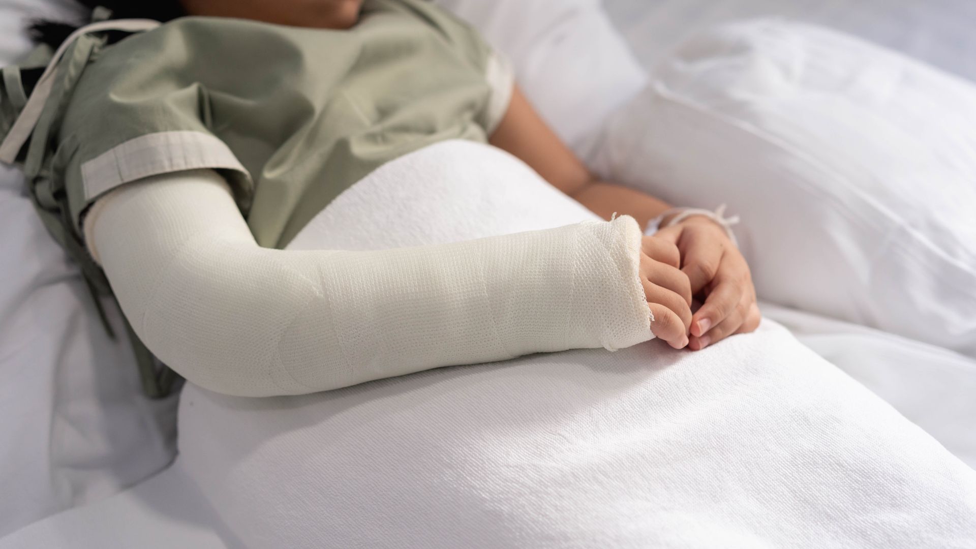 Té ngã là nguyên nhân chính gây gãy trên lồi cầu ở cánh tay trẻ em