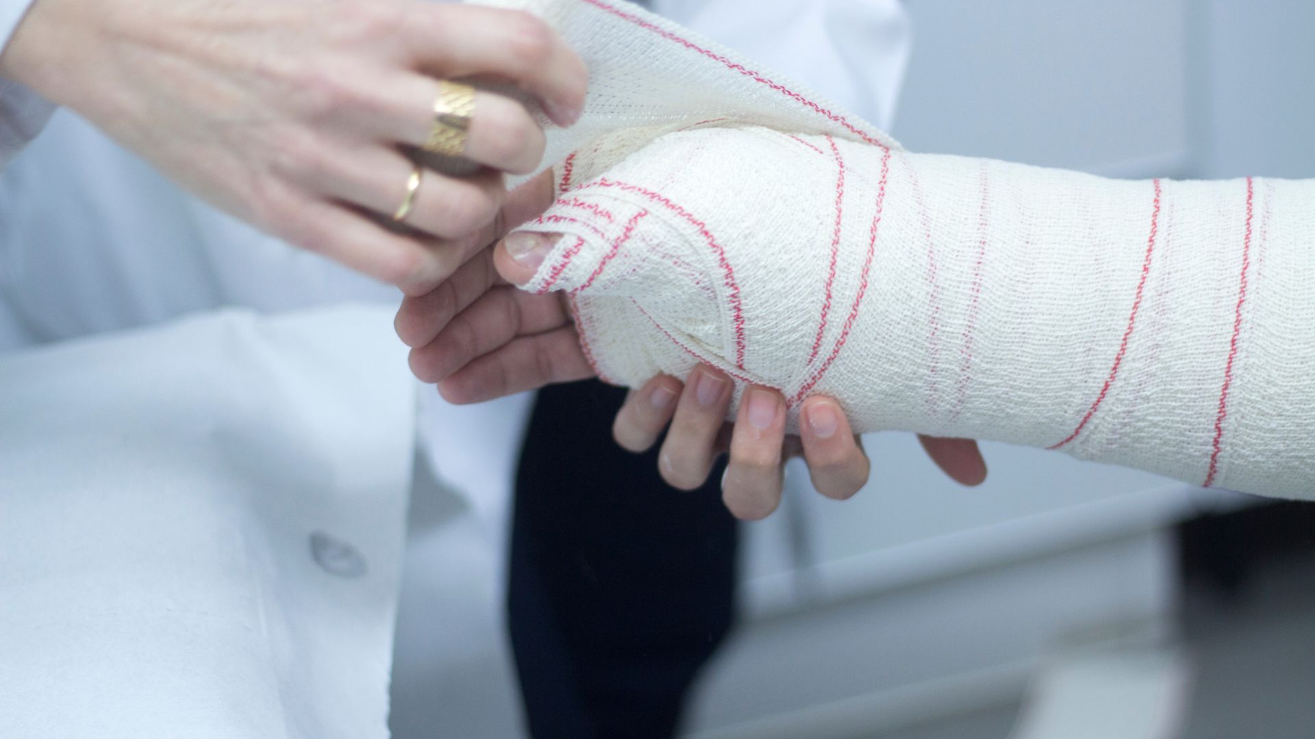 Té ngã là một trong những nguyên nhân phổ biến gây gãy xương bàn tay