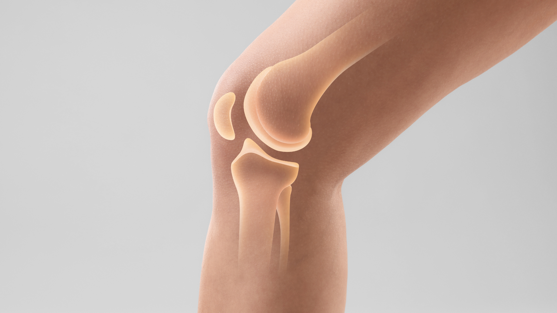 Xương bánh chè là một xương nhỏ nằm phía trước khớp gối