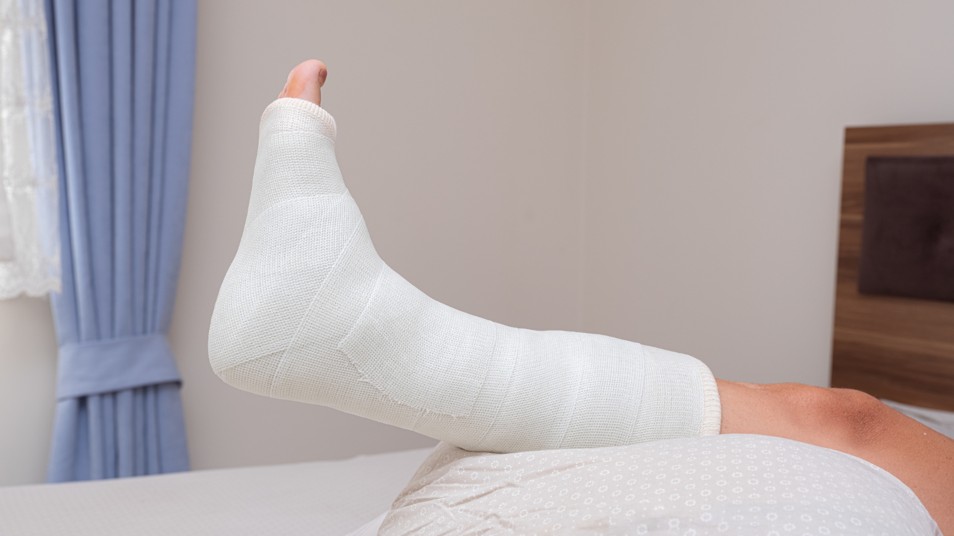 Nếu xương bị di lệch nhẹ, bác sĩ có thể tiến hành nắn chỉnh kín để đưa hai đầu xương về vị trí giải phẫu, sau đó cố định bằng bó bột