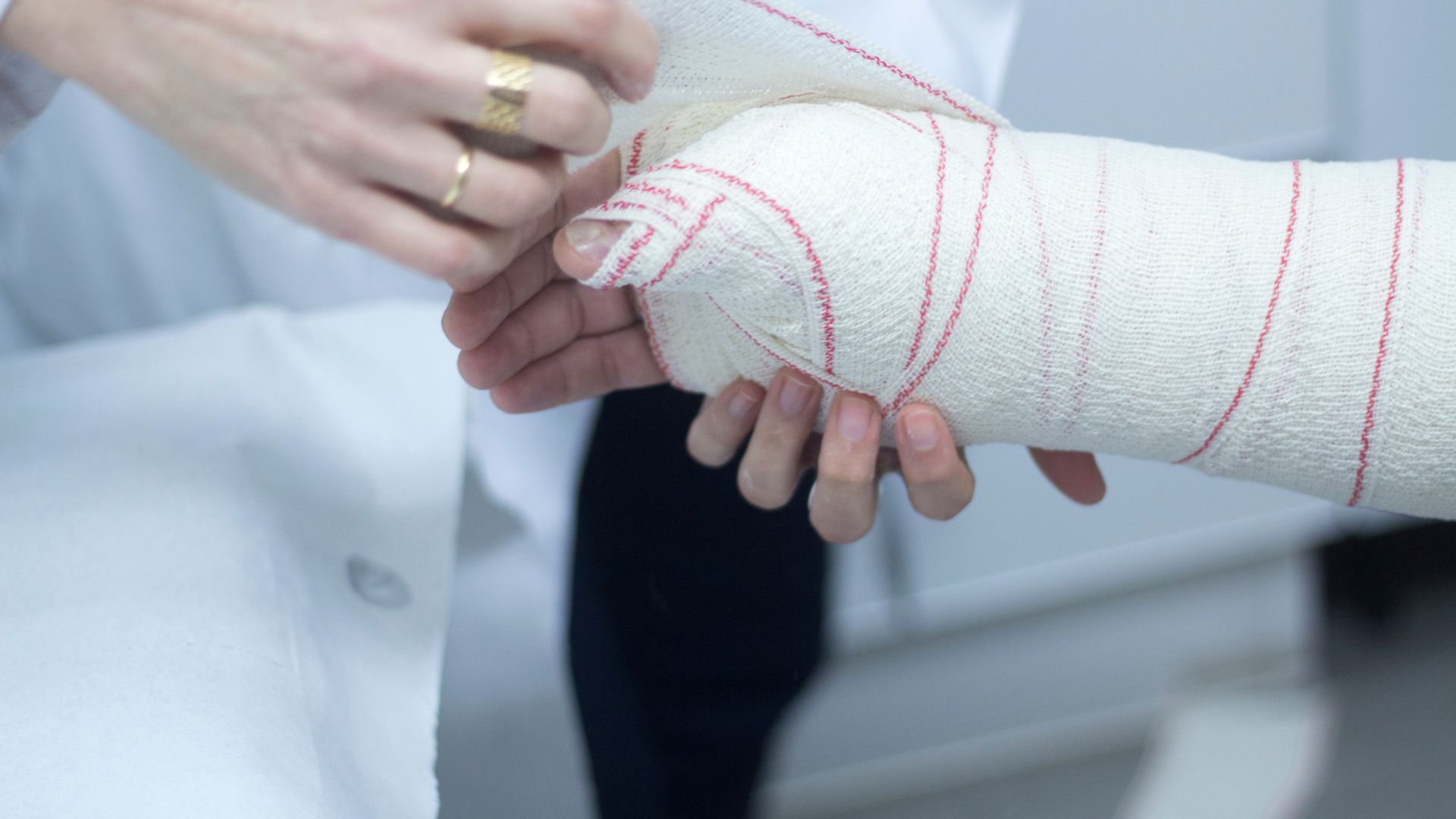 Gãy xương cẳng tay không di lệch thường được chỉ định cố định bằng bó bột