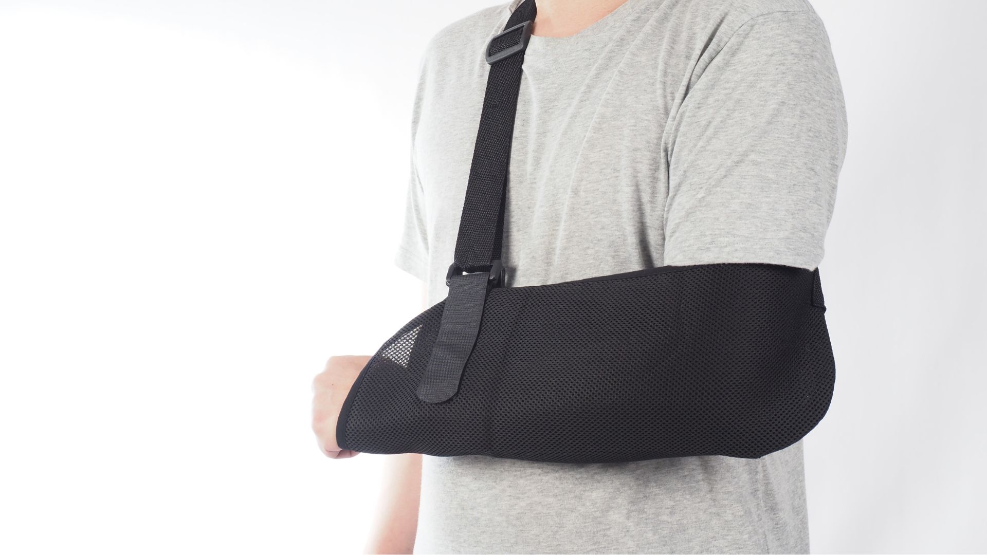 Cố định cánh tay giúp xương liền đúng trục, tránh cử động mạnh khiến xương bị di lệch