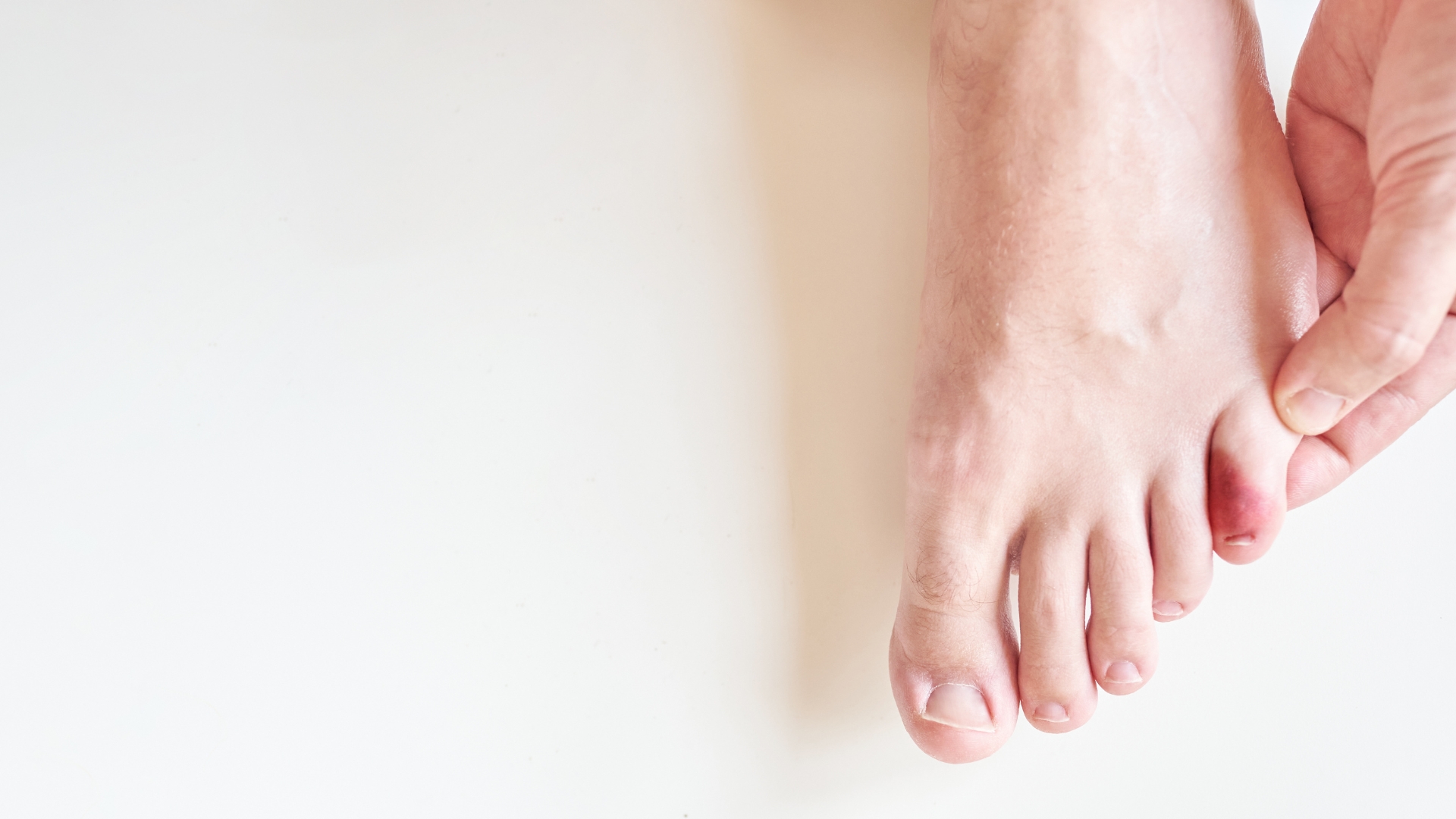 Đau nhói hoặc đau âm ỉ tại ở ngón chân bị tổn thương là một dấu hiệu gãy xương ngón chân