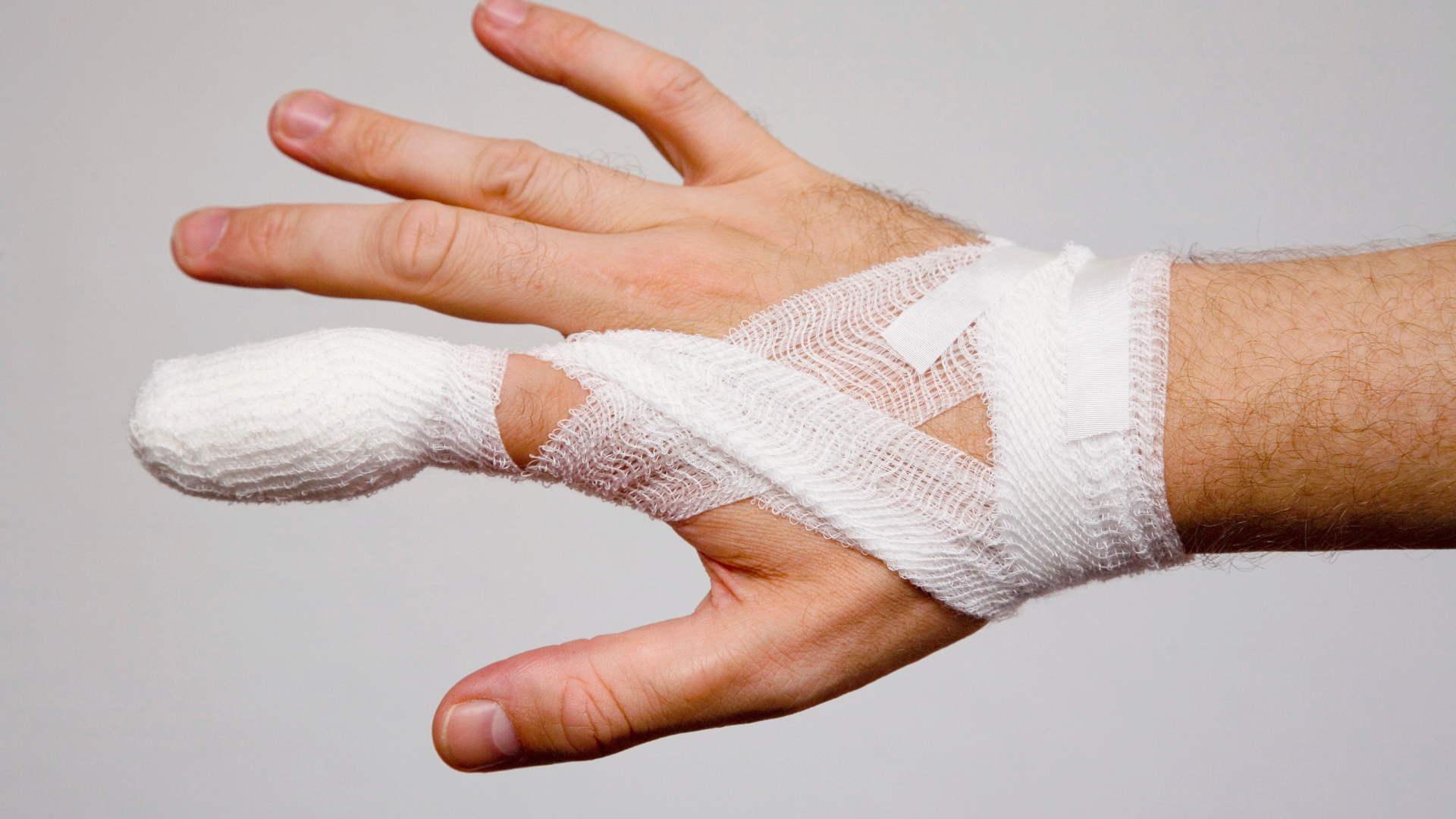 Gãy xương ngón tay bao lâu thì lành là thắc mắc phổ biến của nhiều người