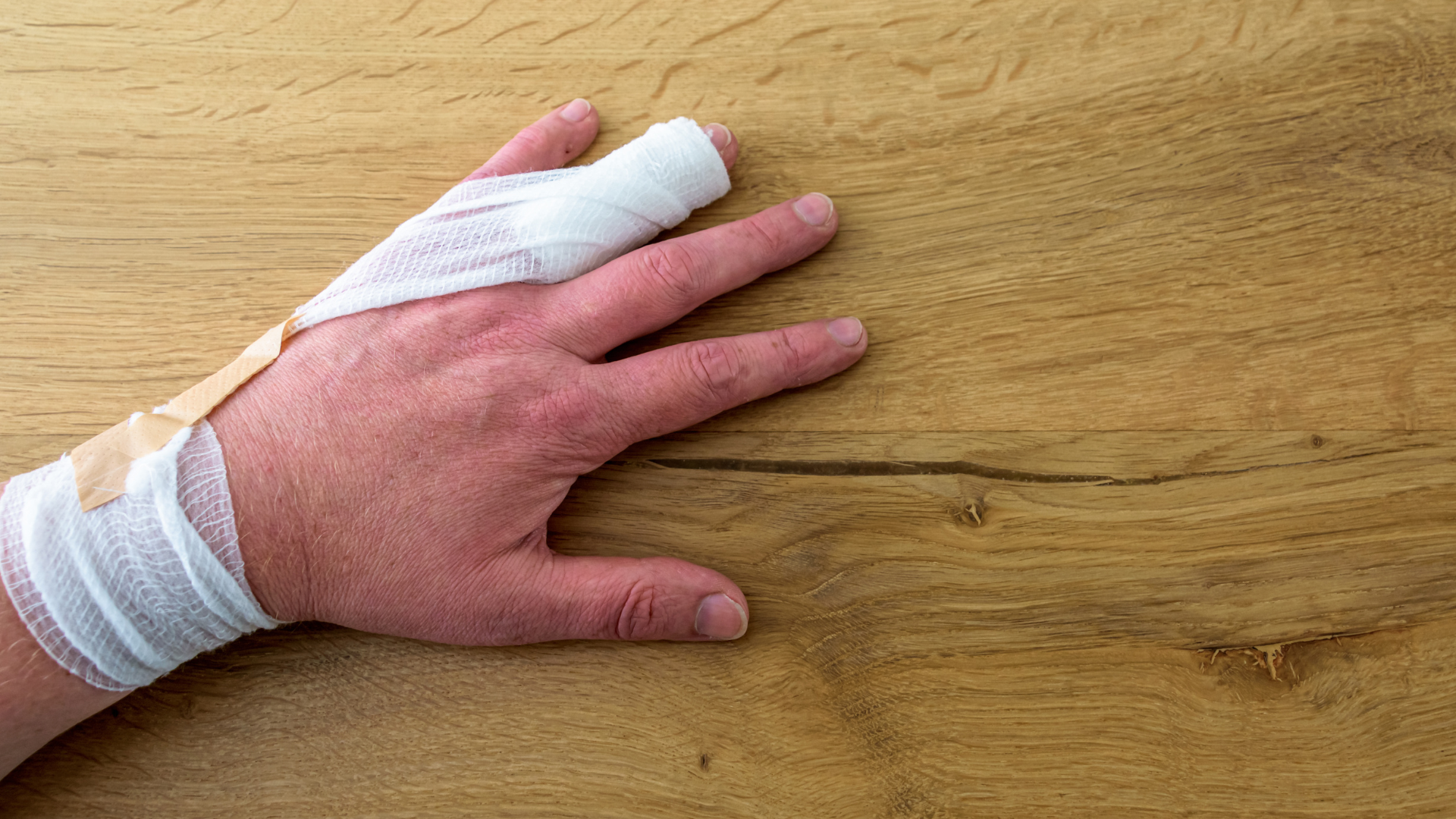 Gãy xương ngón tay là chấn thương thường gặp trong đời sống hằng ngày