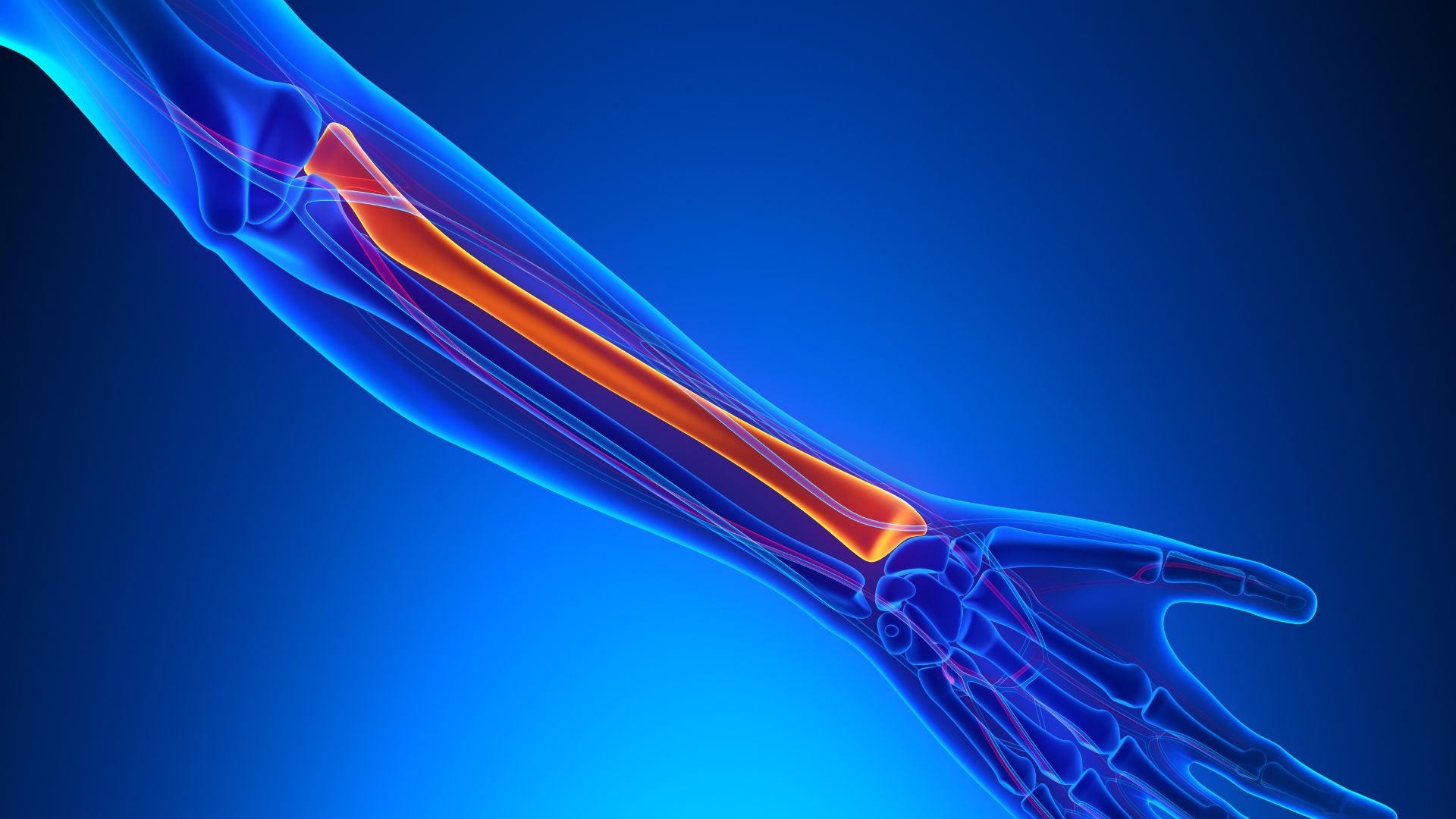 Gãy xương quay tay bao lâu thì lành còn phụ thuộc vào nhiều yếu tố khác nhau