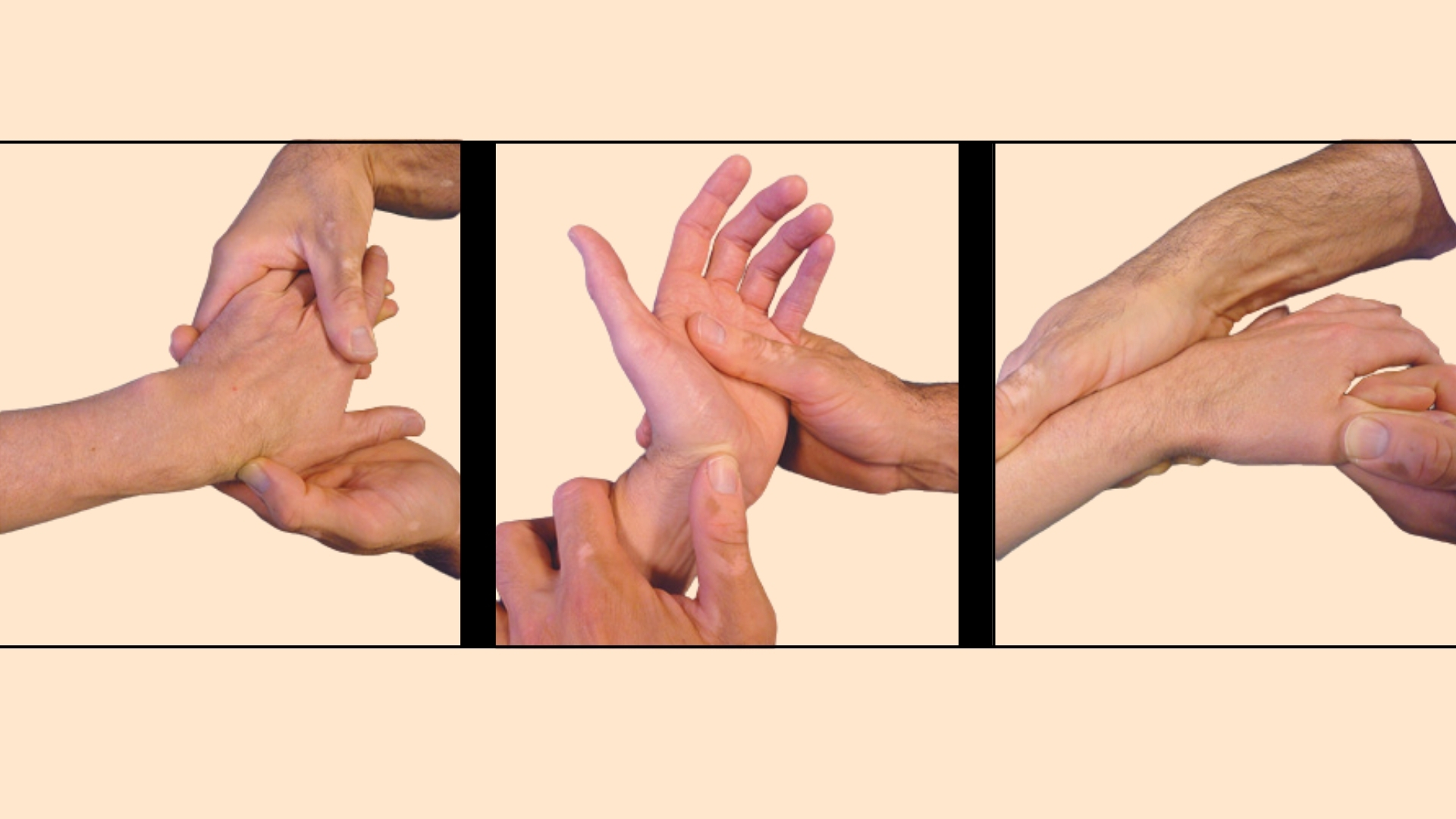 Một số nghiệm pháp như nghiệm pháp nắm tay kết hợp với nghiêng trụ hoặc nghiệm pháp Watson có thể gây đau và hỗ trợ gợi ý tổn thương xương thuyền