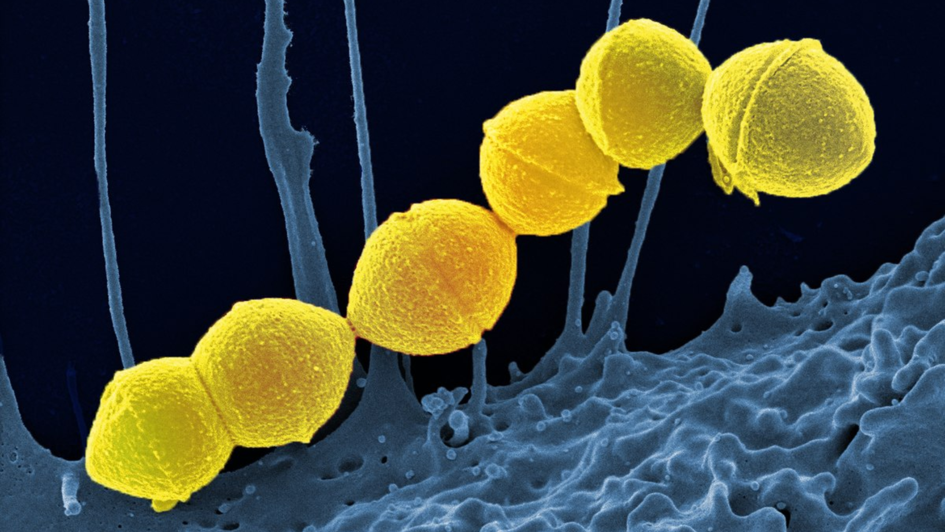 Ghẻ phỏng thường do vi khuẩn Streptococcus pyogenes gây ra, xâm nhập qua vết thương nhỏ hay da trầy xước