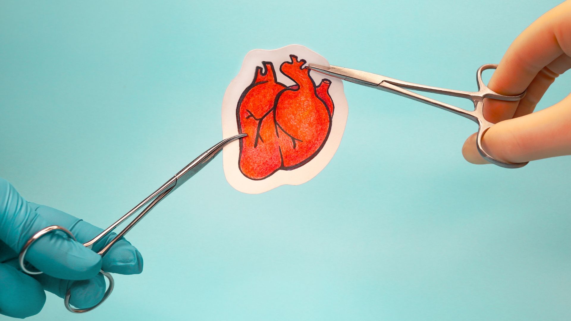 Ghép tim là phương pháp điều trị cuối cùng cho bệnh nhân suy tim giai đoạn cuối