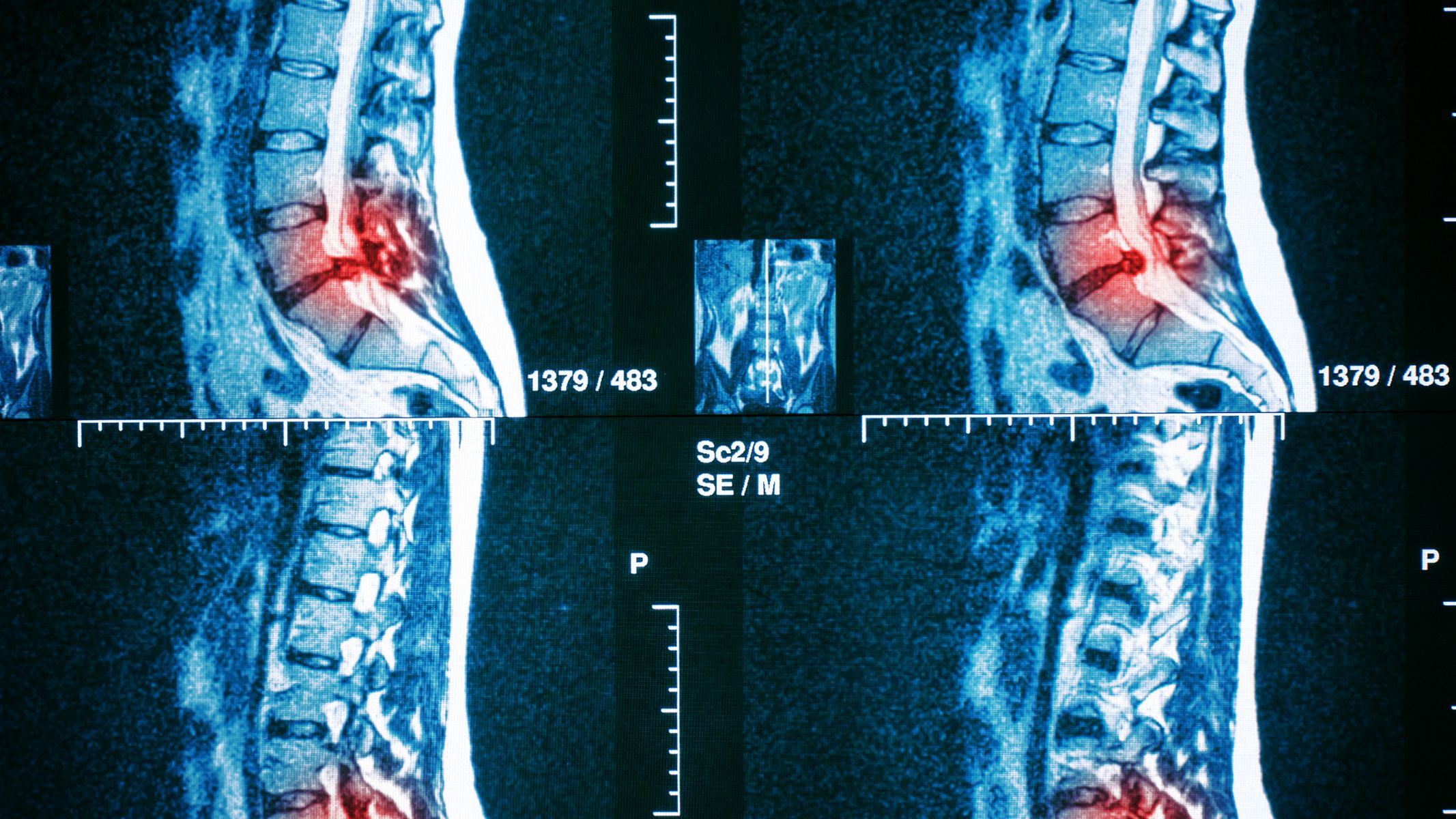 MRI đặc biệt hữu ích trong việc phát hiện và đánh giá nhiều bệnh lý
