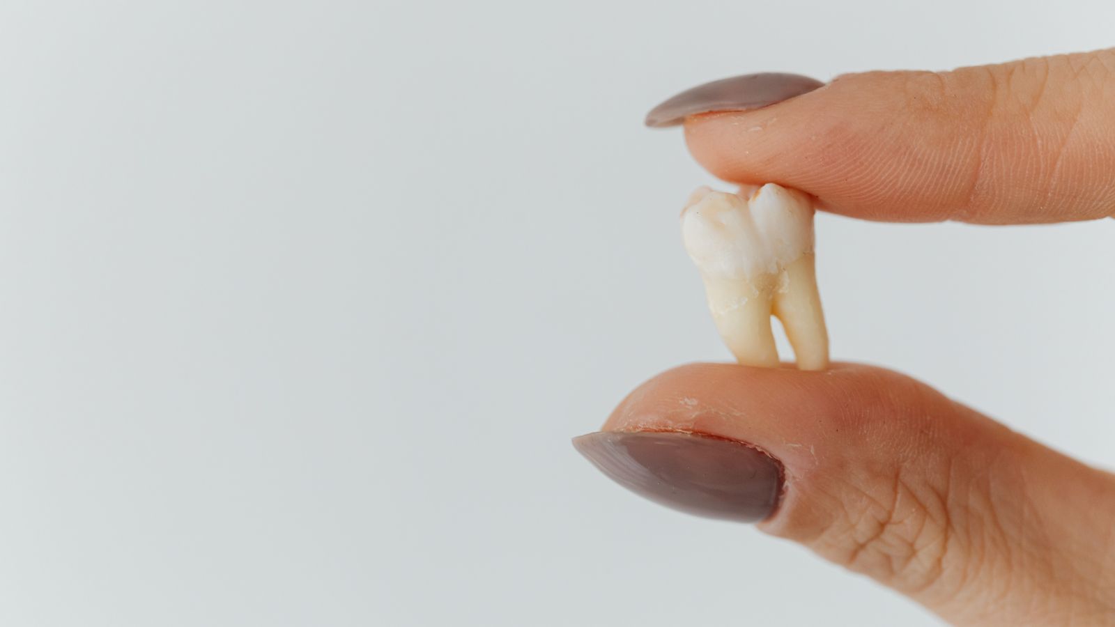 Có một số kinh nghiệm hữu ích giúp bạn giảm bớt chi phí nhổ răng khôn mà vẫn yên tâm