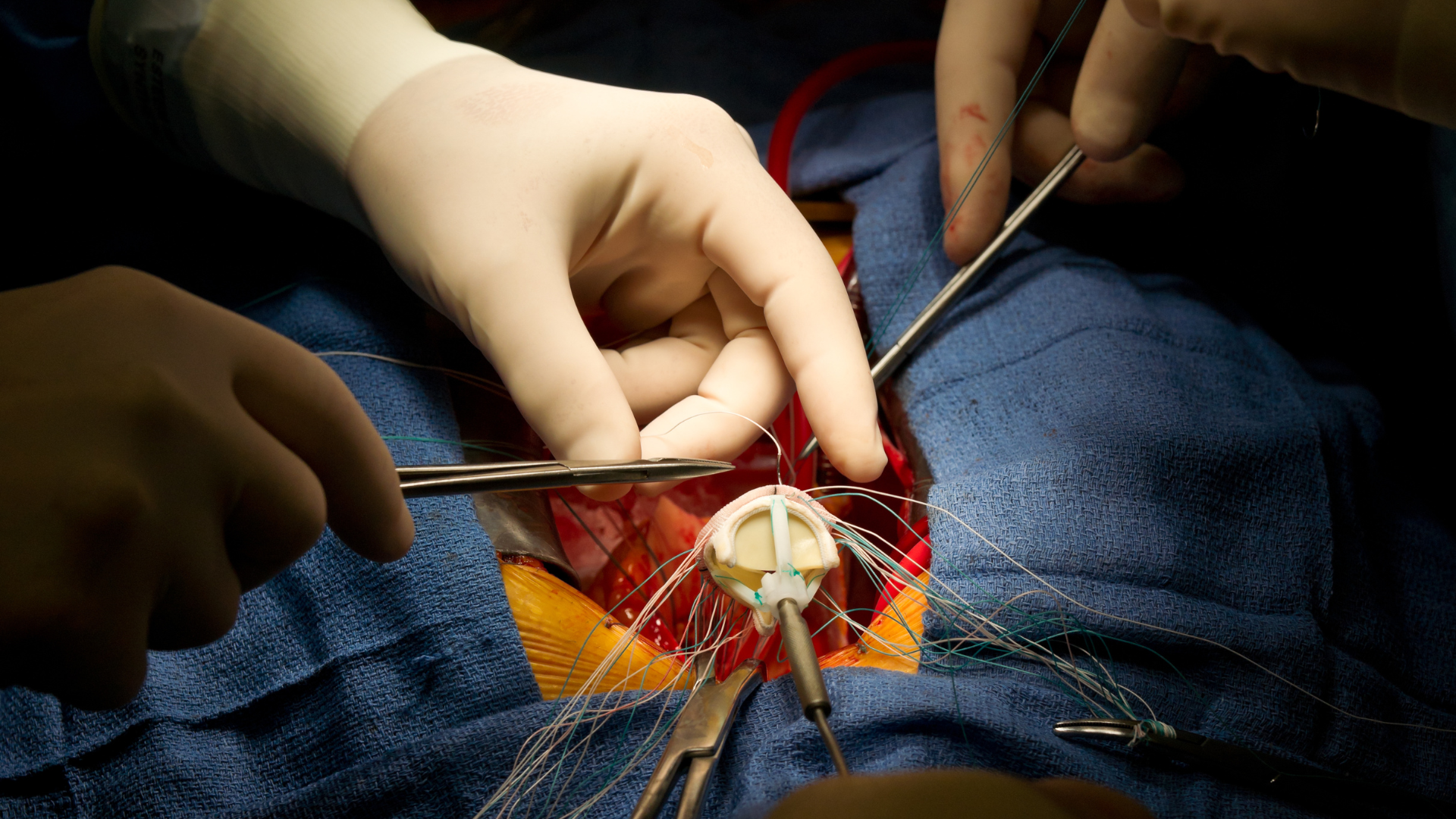 Nắm giải phẫu tim giúp theo dõi cơ chế hoạt động của tim và phát hiện kịp thời các dấu hiệu bất thường.