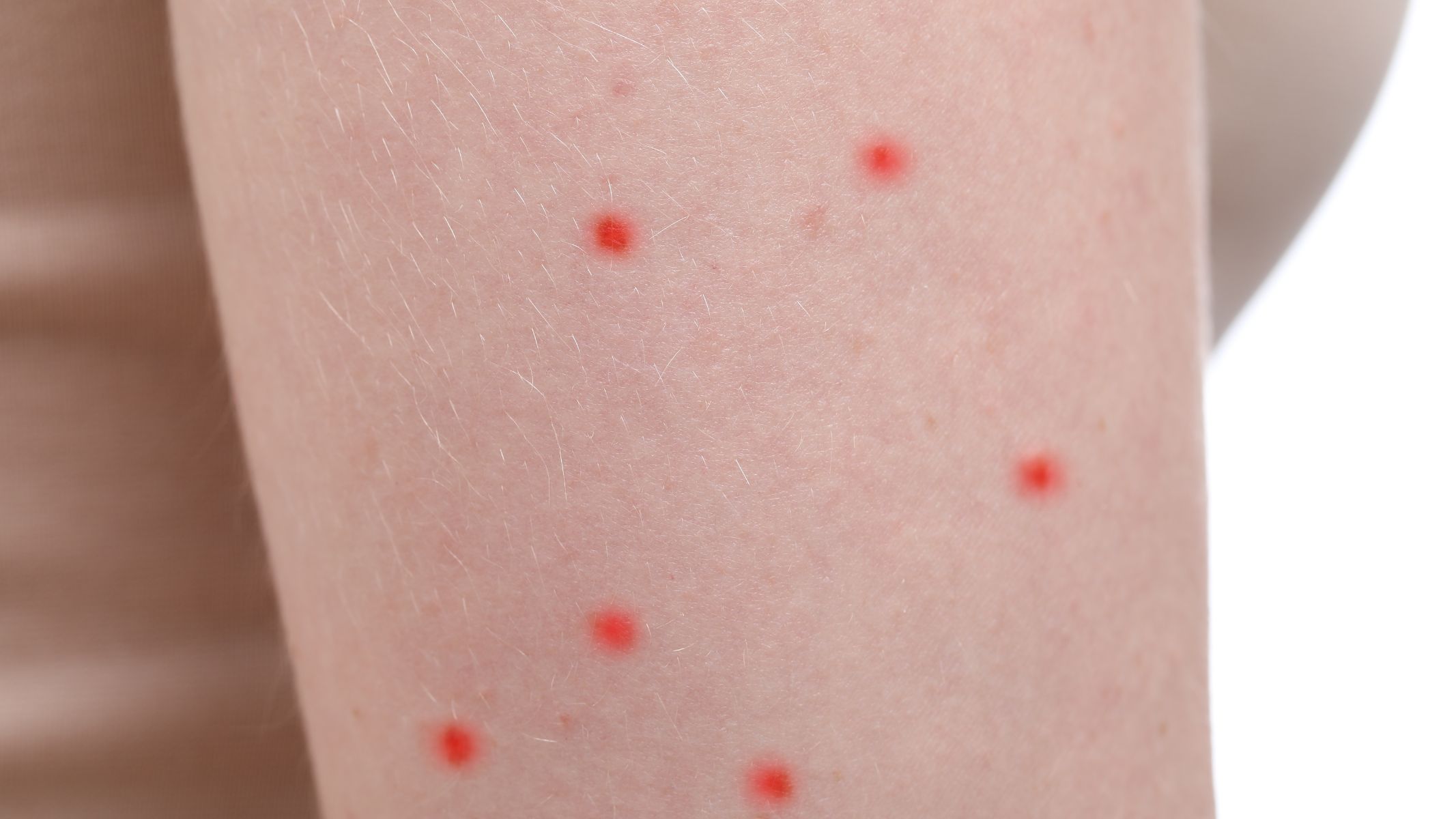 Tiểu cầu giảm bao nhiêu là nguy hiểm?