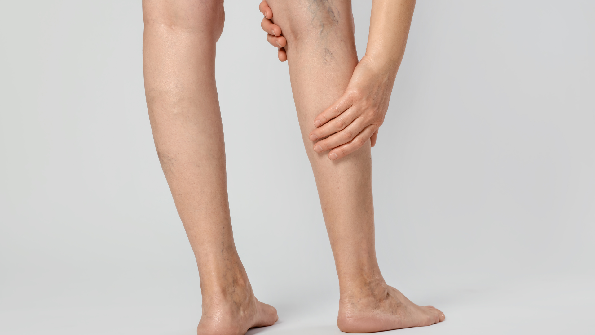 Những lưu ý quan trọng khi tập luyện nếu bị giãn tĩnh mạch chân