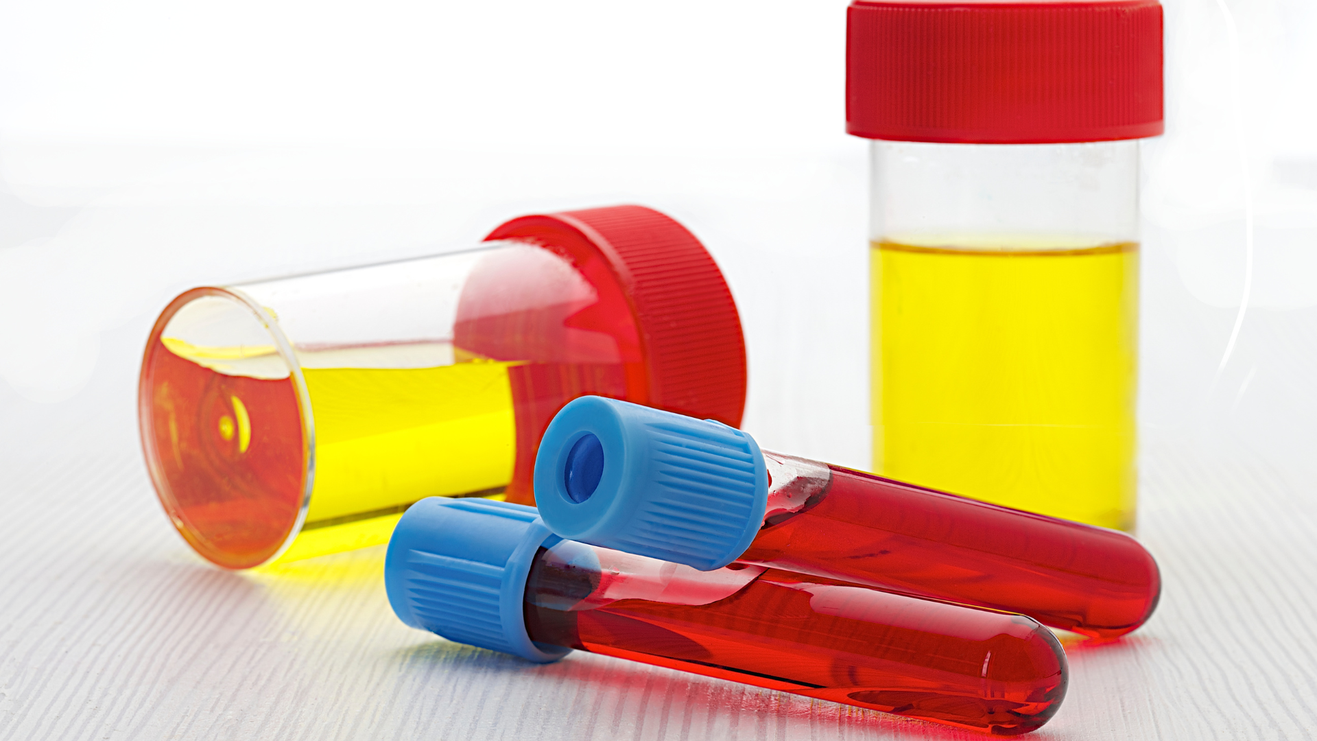 Khi hiểu rõ bảng kết quả bạn sẽ bớt lo lắng hơn